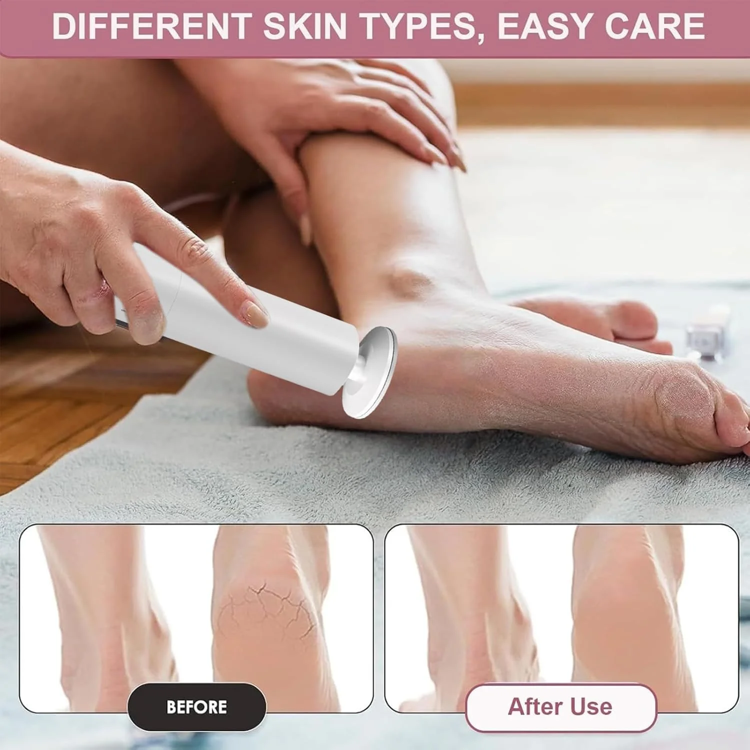 سوهان برقی پینه پا، ابزار پدیکور با سرهای قابل تعویض برای بزرگسالان، زنان و مردان سوهان برقی پینه پا، ابزار پدیکور با سرهای قابل تعویض برای بزرگسالان، زنان و مردان