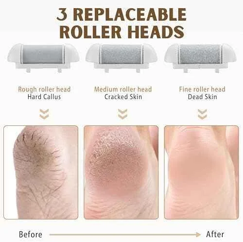 سوهان پدیکور شارژی Barberboss، از بین برنده پوست سفت پا، کیت ضد آب برقی با 3 غلتک، دو سرعته، شارژ USB و نمایشگر LED، ست پدیکور برای پاشنه های ترک خورده و پاهای صاف (طلایی)