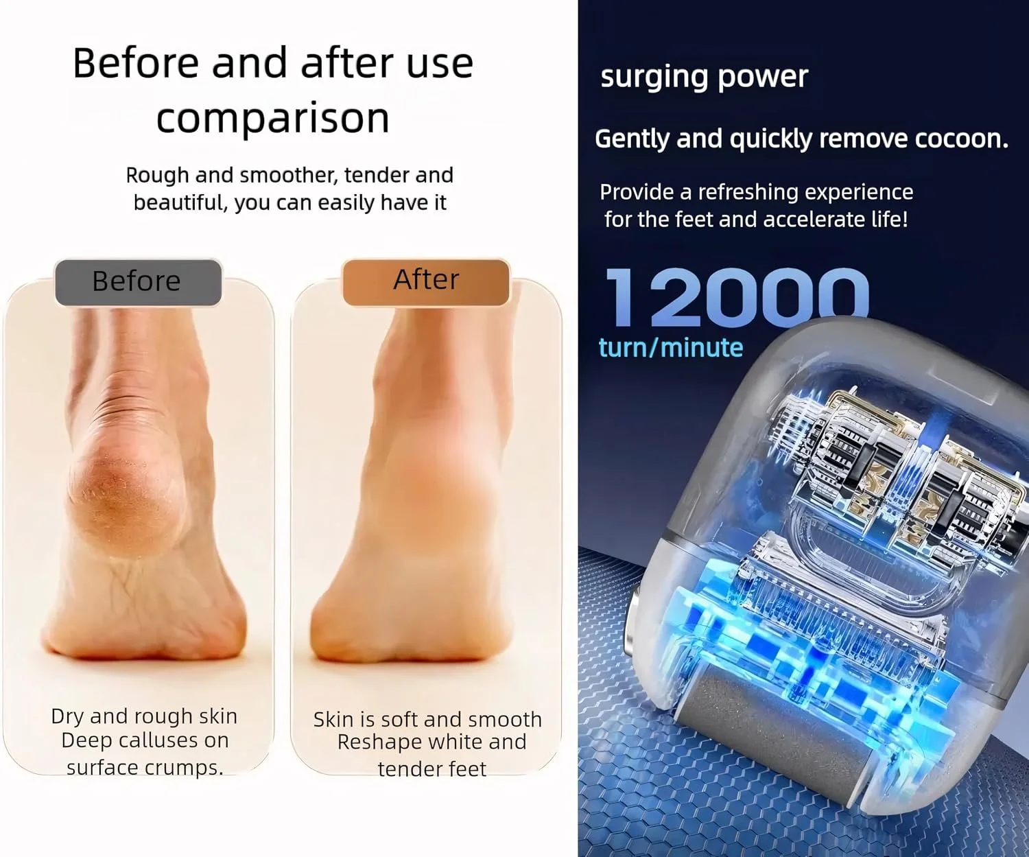 سوهان برقی پا Azonee، ابزار پدیکور ضد آب قابل شارژ با نمایشگر دیجیتال، موتور قدرتمند برای پاشنه و انگشتان پا برای مراقبت آسان از پا، شامل 3 سری سنگ زنی سوهان برقی پا Azonee، ابزار پدیکور ضد آب قابل شارژ با نمایشگر دیجیتال، موتور قدرتمند برای پاشنه و انگشتان پا برای مراقبت آسان از پا، شامل 3 سری سنگ زنی