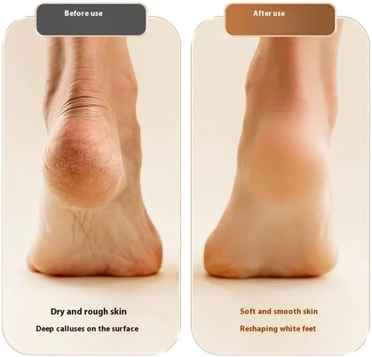 سوهان برقی حرفه ای پا Azonee، ابزار پدیکور قابل حمل و شارژی، برس لایه بردار برقی پا، پولیشر پاشنه پا با نمایشگر دیجیتال، عالی برای پوست مرده/لایه برداری قوی سوهان برقی حرفه ای پا Azonee، ابزار پدیکور قابل حمل و شارژی، برس لایه بردار برقی پا، پولیشر پاشنه پا با نمایشگر دیجیتال، عالی برای پوست مرده/لایه برداری قوی