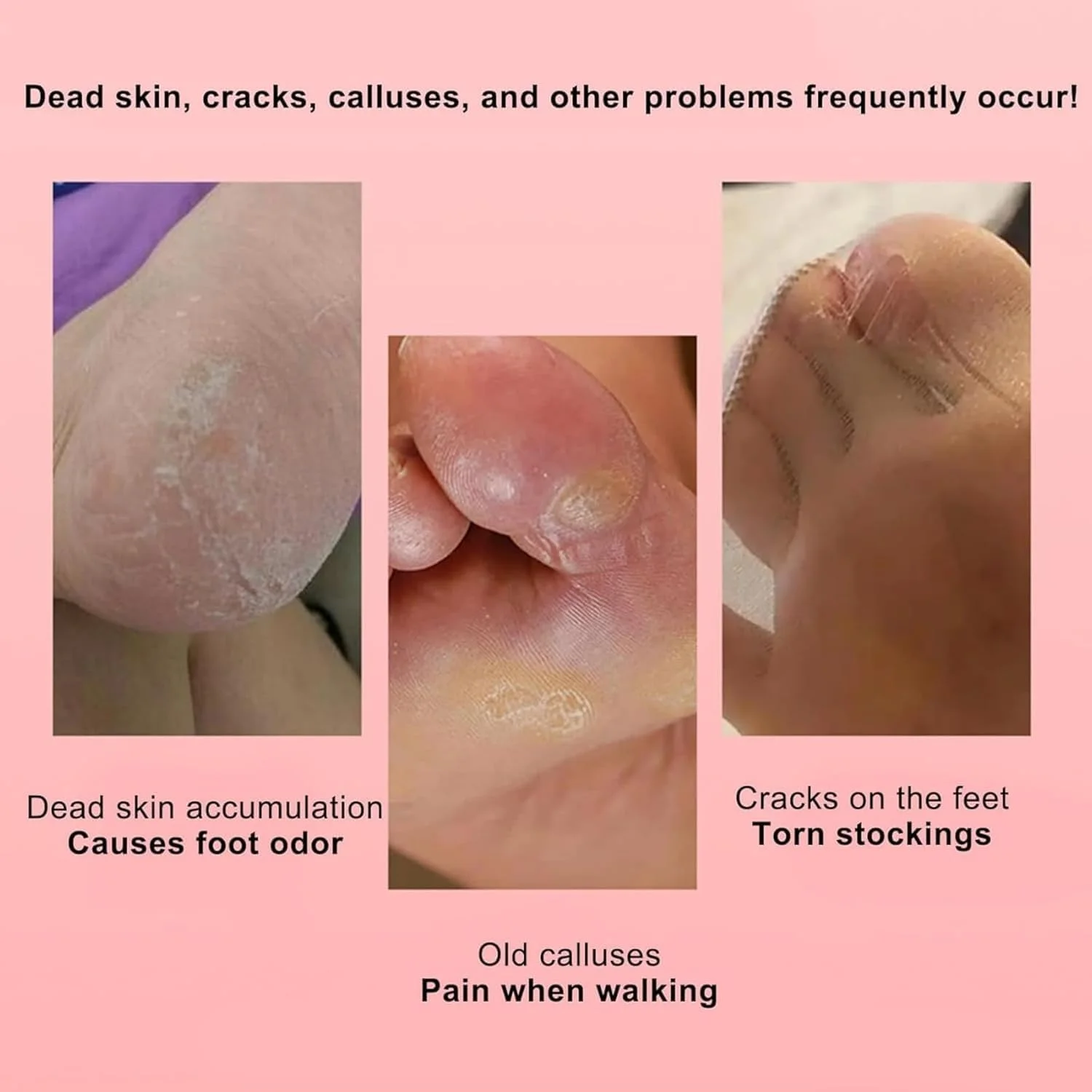 Avalaine Electric Foot Callus Remover, Electric Callus Remover for Feet, 0-800rpm, 360° High Speed Rotation, Foot File, Gentle and Not Hurt Feet for Men Women (Orange) Avalaine Electric Foot Callus Remover, Electric Callus Remover for Feet, 0-800rpm, 360° High Speed Rotation, Foot File, Gentle and Not Hurt Feet for Men Women (Orange)