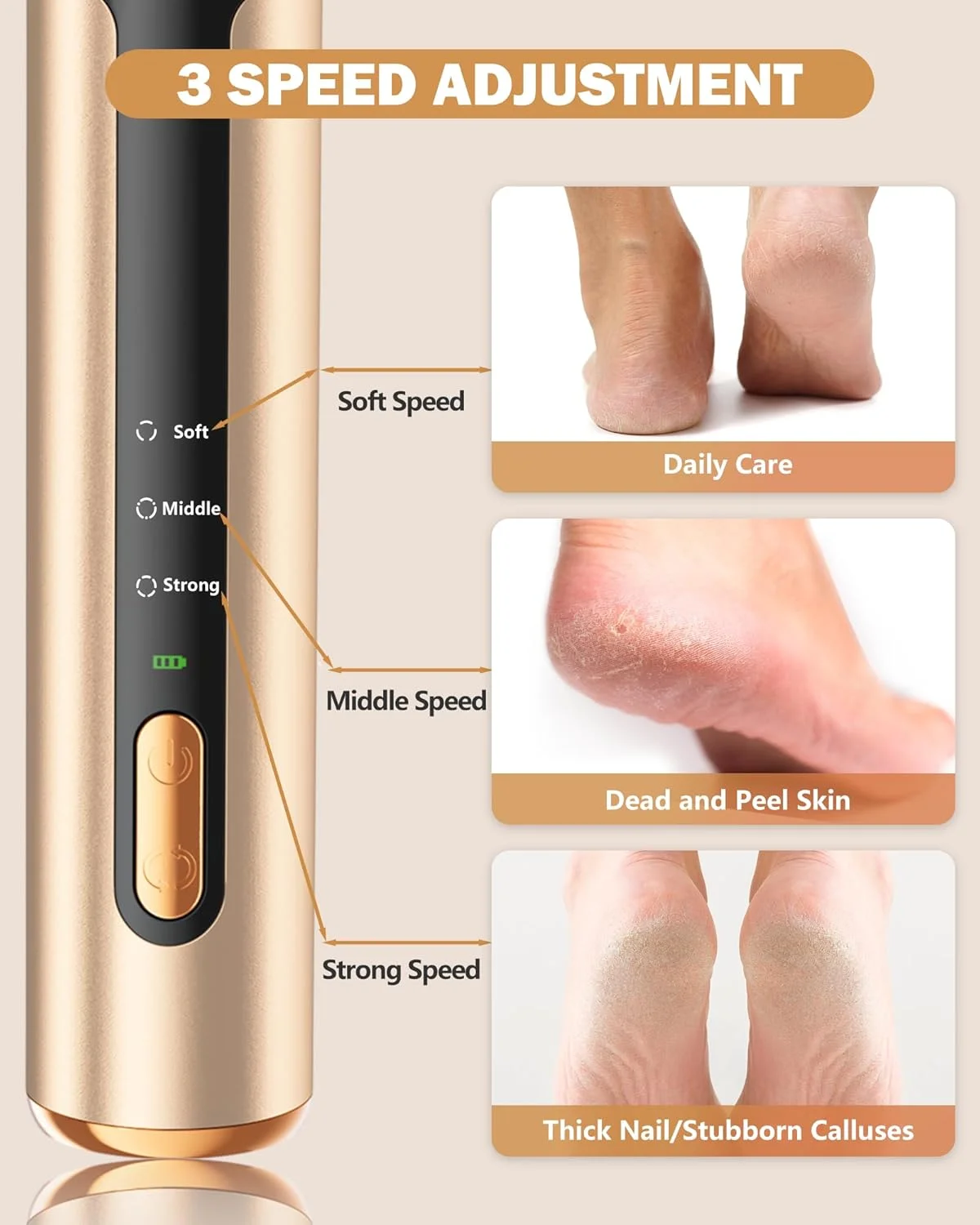 سوهان برقی پینه پا AvantShine، از بین برنده پینه پا با 60 عدد دیسک سمباده، قابل شارژ و دارای سرعت قابل تنظیم با نمایشگر LED، سوهان برقی 2 در 1 برای از بین بردن پوست مرده و مراقبت از ناخن سوهان برقی پینه پا AvantShine، از بین برنده پینه پا با 60 عدد دیسک سمباده، قابل شارژ و دارای سرعت قابل تنظیم با نمایشگر LED، سوهان برقی 2 در 1 برای از بین بردن پوست مرده و مراقبت از ناخن