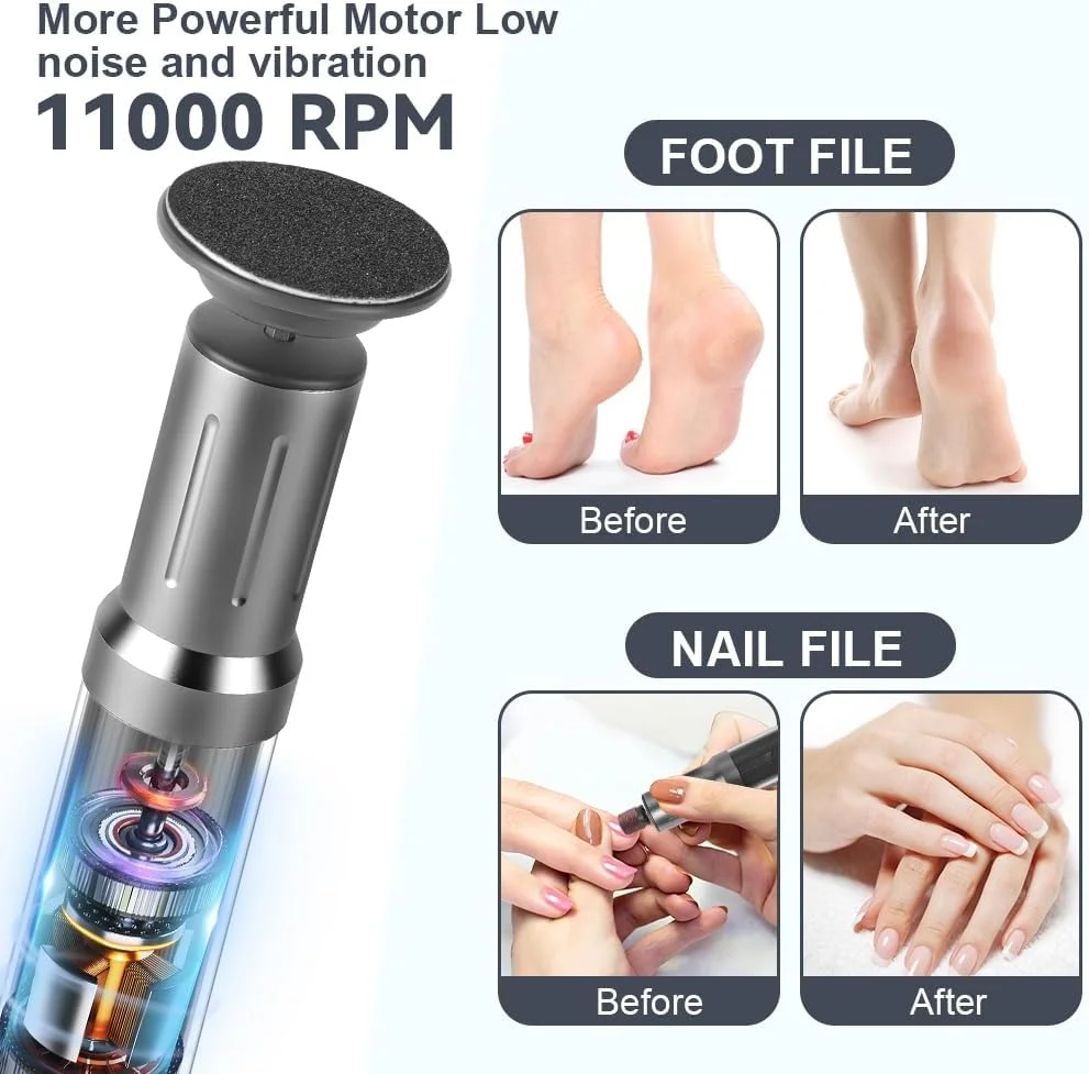 سوهان برقی پا AOOWU، از بین برنده پوست سفت، سوهان برقی 2 در 1 برای پا، از بین برنده پینه پا با پایه شارژ، ابزار پدیکور سمباده برقی پا با 40 عدد دیسک سمباده و حلقه سوهان برقی پا AOOWU، از بین برنده پوست سفت، سوهان برقی 2 در 1 برای پا، از بین برنده پینه پا با پایه شارژ، ابزار پدیکور سمباده برقی پا با 40 عدد دیسک سمباده و حلقه