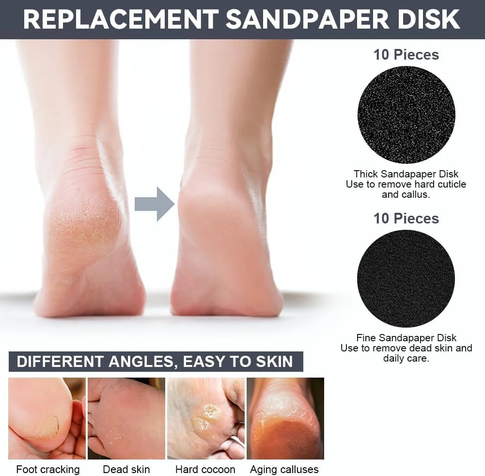 سوهان برقی پا AOOWU، از بین برنده پوست سفت، سوهان برقی 2 در 1 برای پا، از بین برنده پینه پا با پایه شارژ، ابزار پدیکور سمباده برقی پا با 40 عدد دیسک سمباده و حلقه سوهان برقی پا AOOWU، از بین برنده پوست سفت، سوهان برقی 2 در 1 برای پا، از بین برنده پینه پا با پایه شارژ، ابزار پدیکور سمباده برقی پا با 40 عدد دیسک سمباده و حلقه