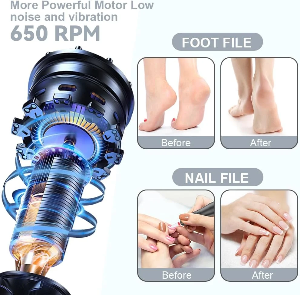 سوهان برقی پینه پا AOOWU، مجموعه سوهان برقی قابل شارژ پا با سرهای سوهان قابل تعویض، سرعت قابل تنظیم، مجموعه مراقبت از پا برای پاشنه های ترک خورده، پینه و پوست مرده سوهان برقی پینه پا AOOWU، مجموعه سوهان برقی قابل شارژ پا با سرهای سوهان قابل تعویض، سرعت قابل تنظیم، مجموعه مراقبت از پا برای پاشنه های ترک خورده، پینه و پوست مرده
