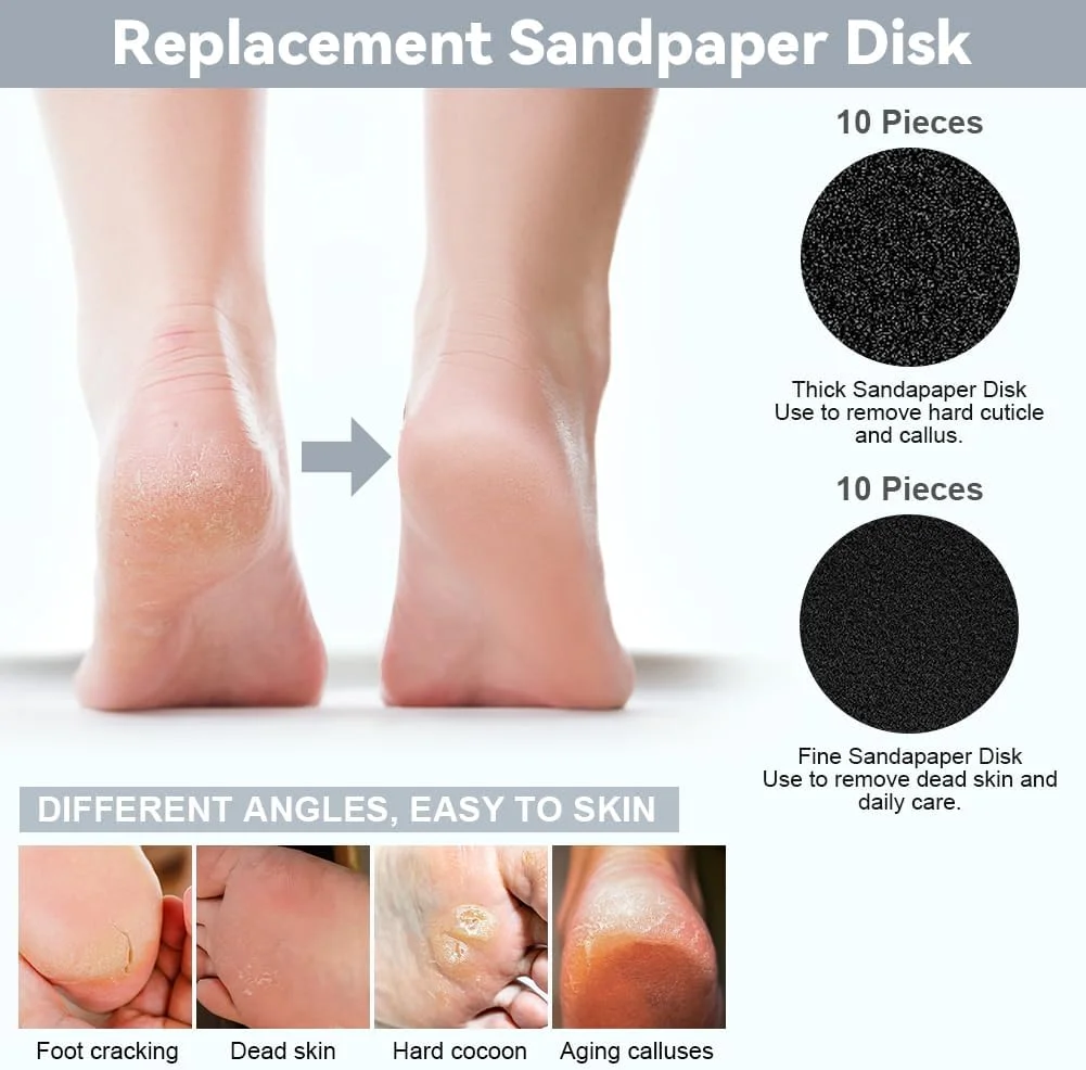 سوهان برقی پینه پا AOOWU، مجموعه سوهان برقی قابل شارژ پا با سرهای سوهان قابل تعویض، سرعت قابل تنظیم، مجموعه مراقبت از پا برای پاشنه های ترک خورده، پینه و پوست مرده سوهان برقی پینه پا AOOWU، مجموعه سوهان برقی قابل شارژ پا با سرهای سوهان قابل تعویض، سرعت قابل تنظیم، مجموعه مراقبت از پا برای پاشنه های ترک خورده، پینه و پوست مرده