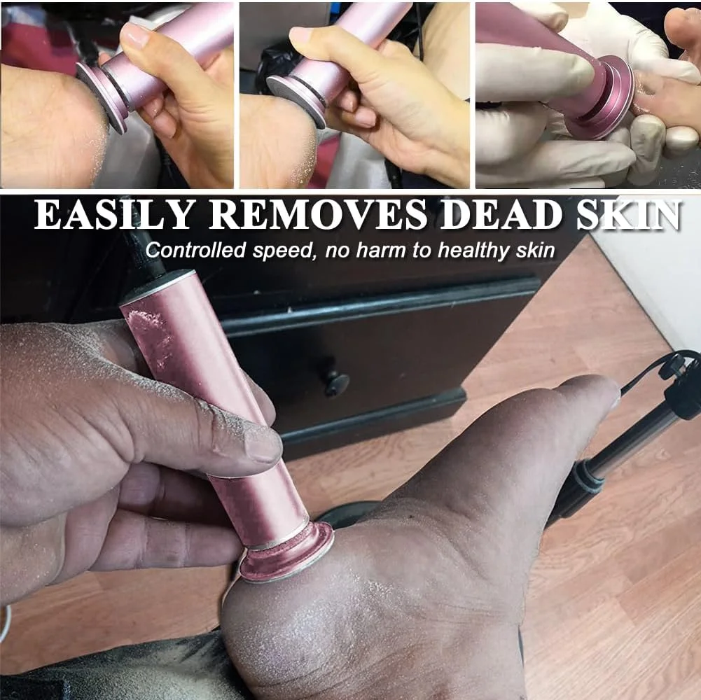 سوهان برقی پا AONOLOVO، از بین برنده پوست سفت (با قابلیت تنظیم سرعت) به همراه 60 عدد دیسک سمباده ای جایگزین، اسکرابر حرفه ای برقی پدیکور پا، از بین برنده پوست سفت (صورتی)