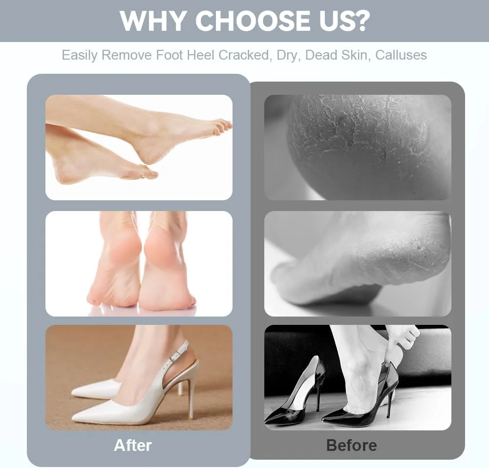 سوهان برقی پینه پا AOOWU، مجموعه سوهان برقی قابل شارژ پا با سرهای سوهان قابل تعویض، سرعت قابل تنظیم، مجموعه مراقبت از پا برای پاشنه های ترک خورده، پینه و پوست مرده سوهان برقی پینه پا AOOWU، مجموعه سوهان برقی قابل شارژ پا با سرهای سوهان قابل تعویض، سرعت قابل تنظیم، مجموعه مراقبت از پا برای پاشنه های ترک خورده، پینه و پوست مرده