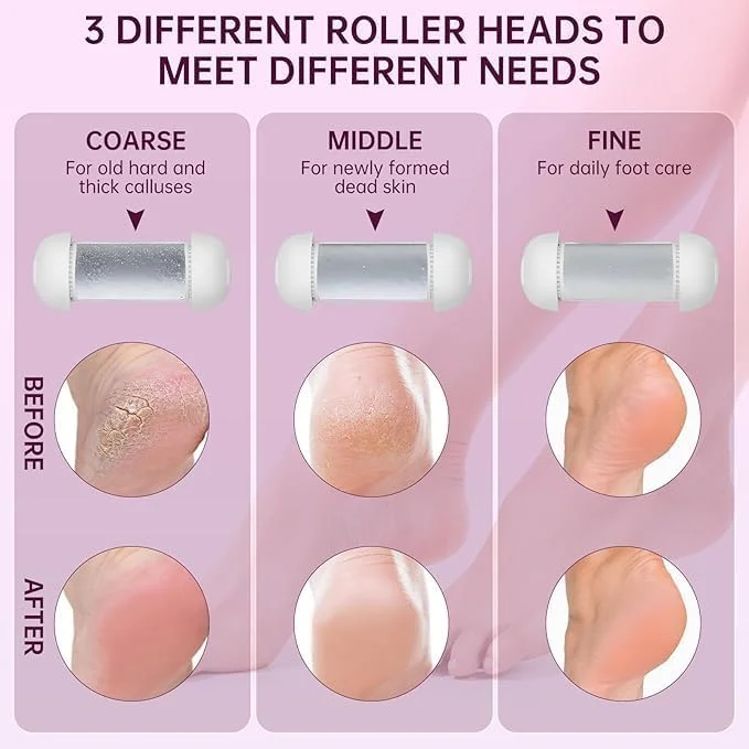 سوهان برقی پا AoMige، ست ابزار پدیکور الکترونیکی قابل حمل همه کاره با مکنده پوست مرده، برس پای شارژی با سرهای تعویضی و ابزار پدیکور، نمایشگر LCD سوهان برقی پا AoMige، ست ابزار پدیکور الکترونیکی قابل حمل همه کاره با مکنده پوست مرده، برس پای شارژی با سرهای تعویضی و ابزار پدیکور، نمایشگر LCD