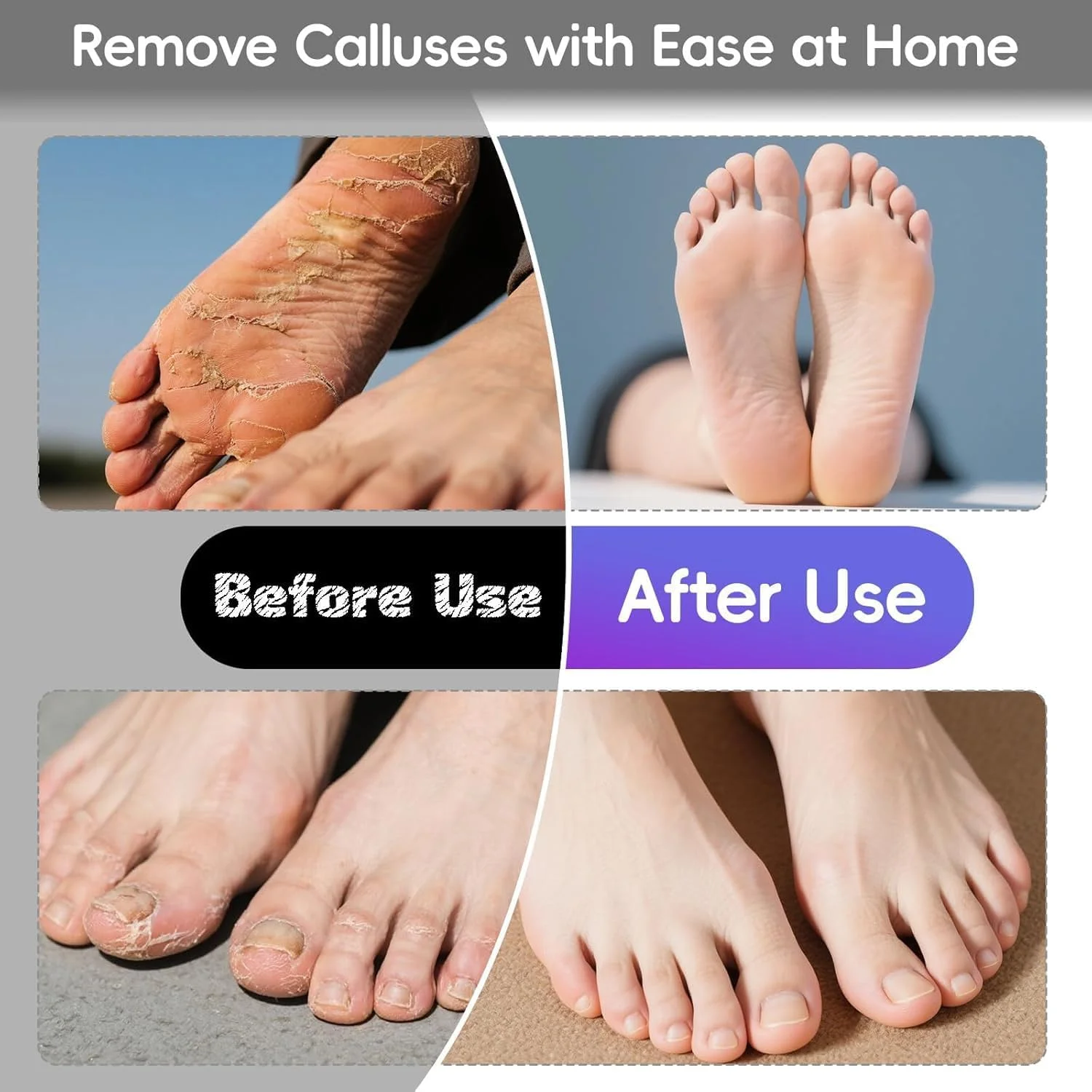 سوهان برقی پدیکور پا 500 دور در دقیقه: ابزار حرفه ای پدیکور برای از بین بردن پینه - دستگاه سنگ پا برقی برای پوست و پینه با 60 عدد دیسک سمباده سوهان برقی پدیکور پا 500 دور در دقیقه: ابزار حرفه ای پدیکور برای از بین بردن پینه - دستگاه سنگ پا برقی برای پوست و پینه با 60 عدد دیسک سمباده