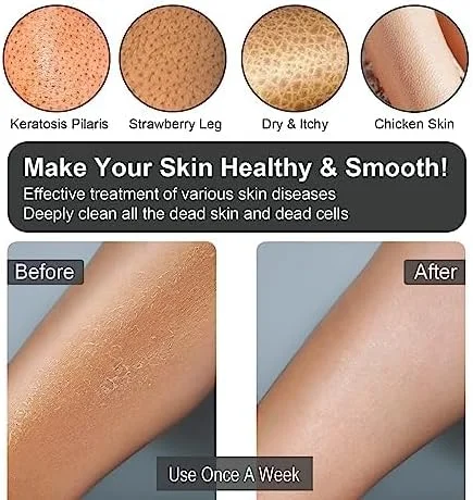 دستکش لایه بردار Yiclick، 2 عدد، دستکش لایه بردار عمقی، لایه بردار بدن، اسکرابر لایه بردار بدن برای لایه برداری حمام و دوش، برای از بین بردن پوست مرده، درمان کراتوز پیلاریس پا دستکش لایه بردار Yiclick، 2 عدد، دستکش لایه بردار عمقی، لایه بردار بدن، اسکرابر لایه بردار بدن برای لایه برداری حمام و دوش، برای از بین بردن پوست مرده، درمان کراتوز پیلاریس پا