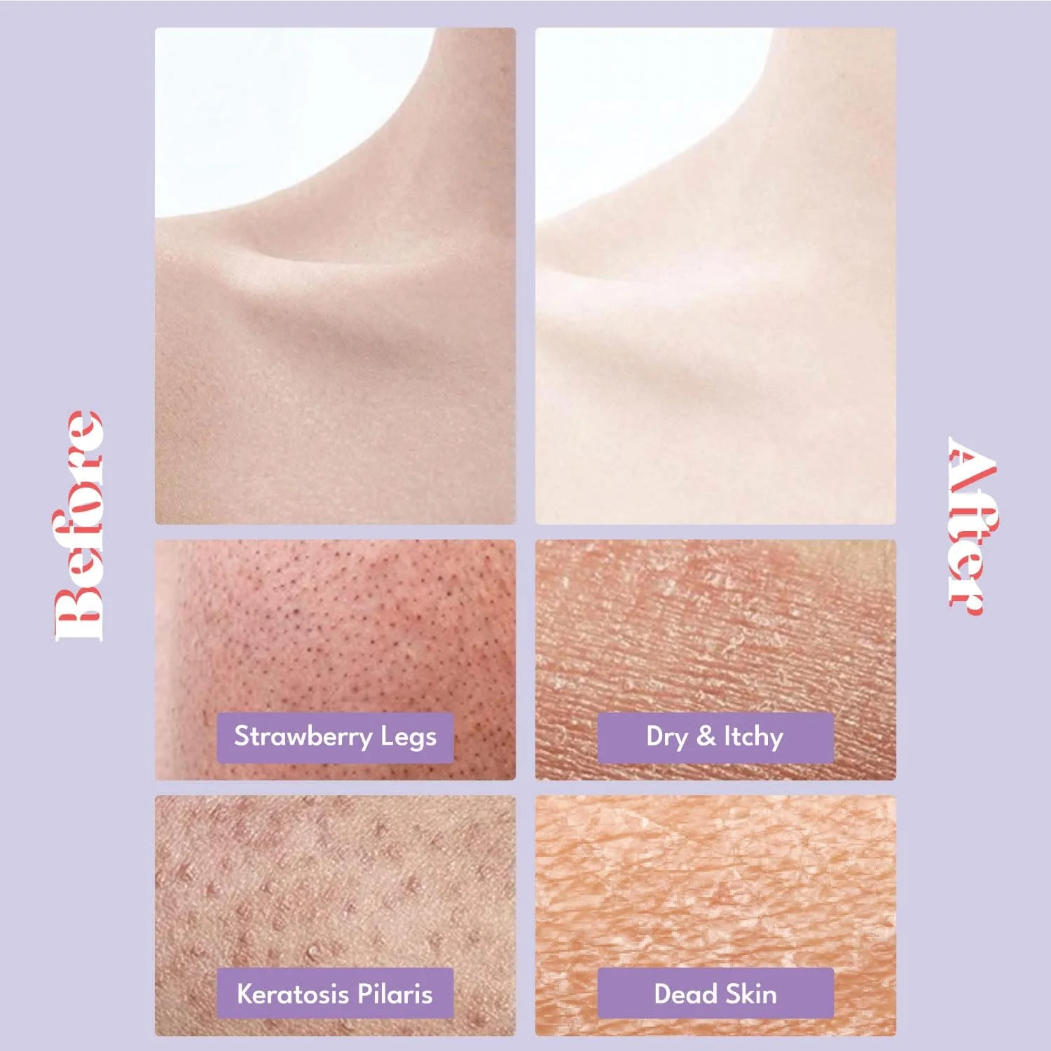 پد لایه بردار حباب دار بدن Toi:L Gentle Touch (5 عدد)، اسکراب بدن، دستکش لایه بردار بدن، لیف، لوفا بدن، حمام حباب متراکم، دوش حمام، از بین برنده برآمدگی های KP پد لایه بردار حباب دار بدن Toi:L Gentle Touch (5 عدد)، اسکراب بدن، دستکش لایه بردار بدن، لیف، لوفا بدن، حمام حباب متراکم، دوش حمام، از بین برنده برآمدگی های KP