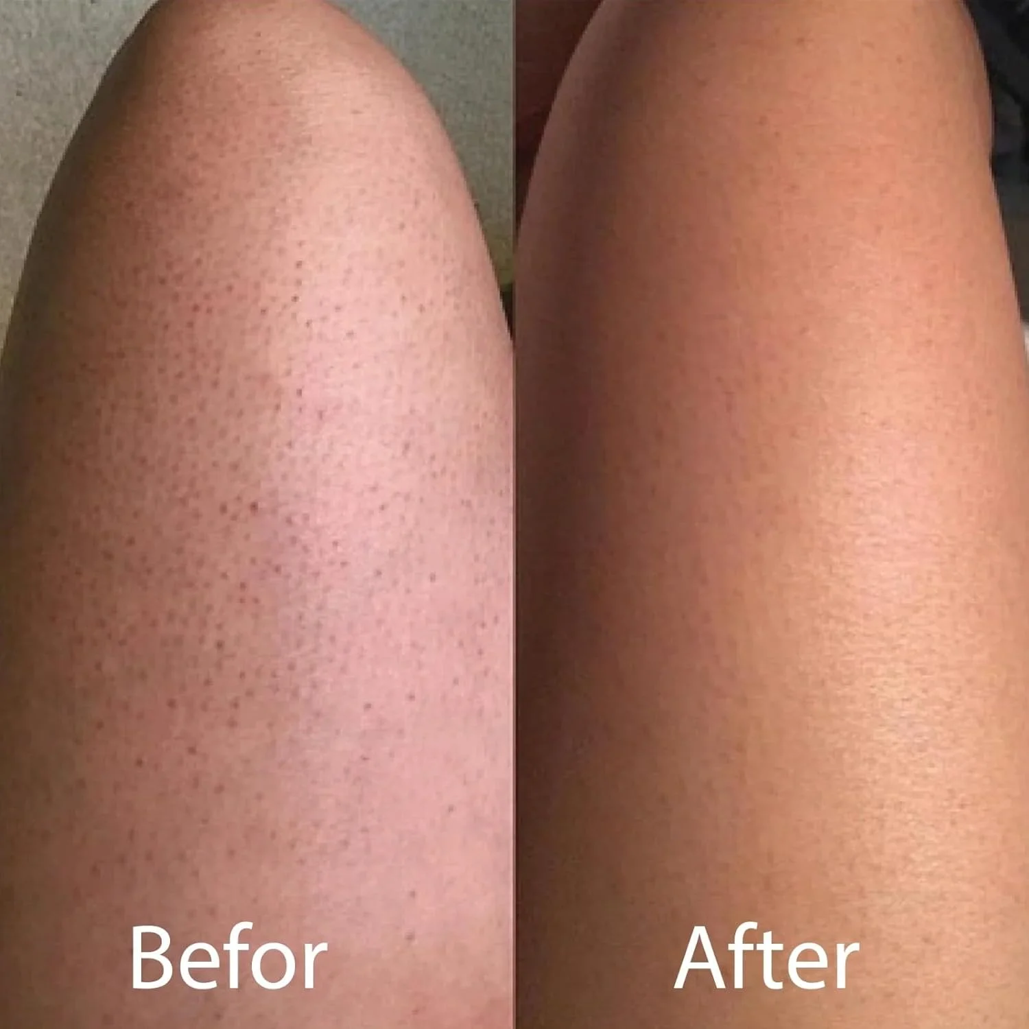 دستکش لایه بردار ابریشمی بدن – دستکش و اسکراب 100% ابریشم خالص توت برای از بین بردن پوست مرده و برنزه، پاکسازی عمیق و لایه برداری طبیعی – ملایم برای انواع پوست – از پینکی گلو (یک بسته)