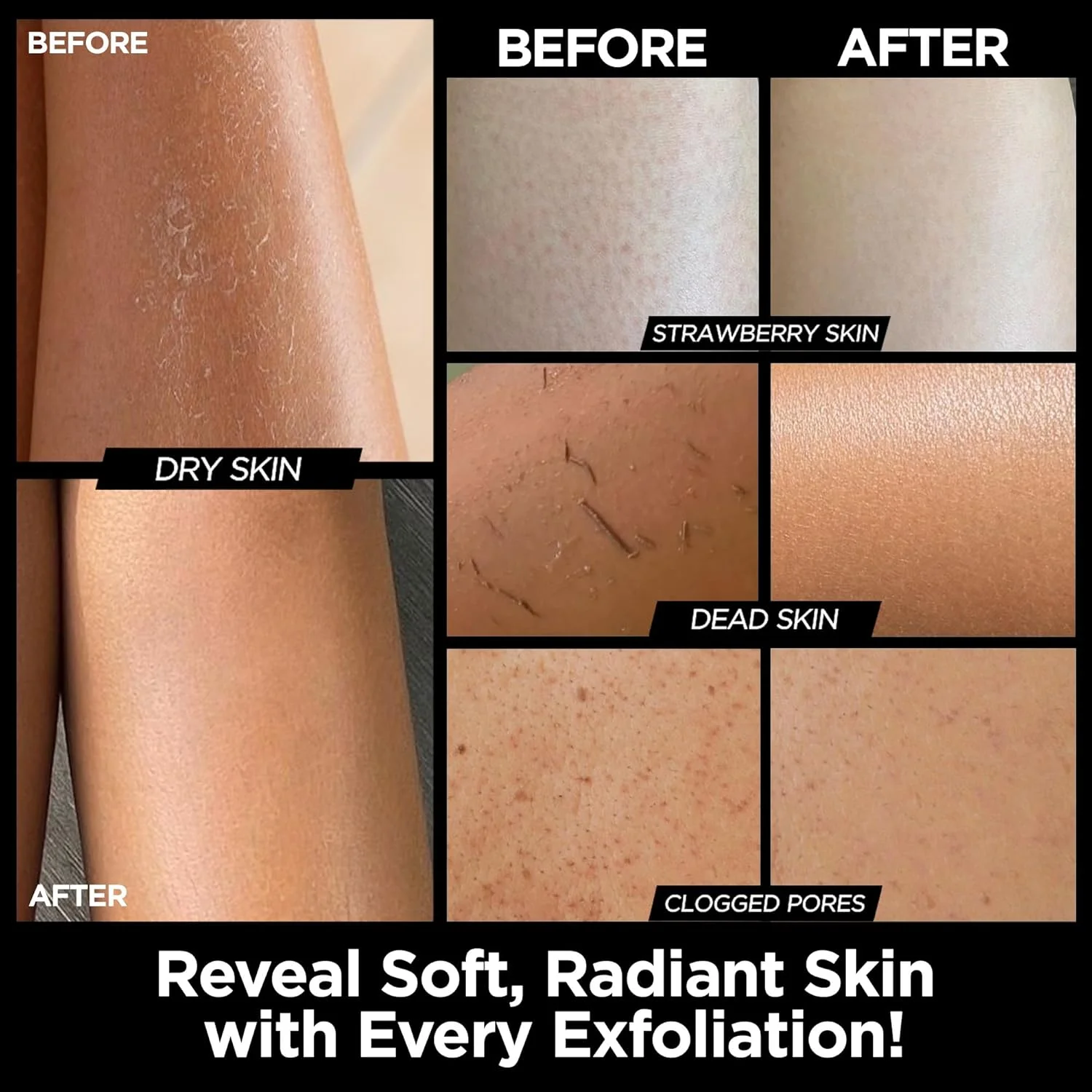 دستکش لایه بردار حمام ام اس برای اسکراب بدن (کیسه) - بسته 2 عددی - برای لایه برداری پوست مرده و پاکسازی عمیق منافذ - الیاف ویسکوز ملایم - توسط موروکان سورس دستکش لایه بردار حمام ام اس برای اسکراب بدن (کیسه) - بسته 2 عددی - برای لایه برداری پوست مرده و پاکسازی عمیق منافذ - الیاف ویسکوز ملایم - توسط موروکان سورس