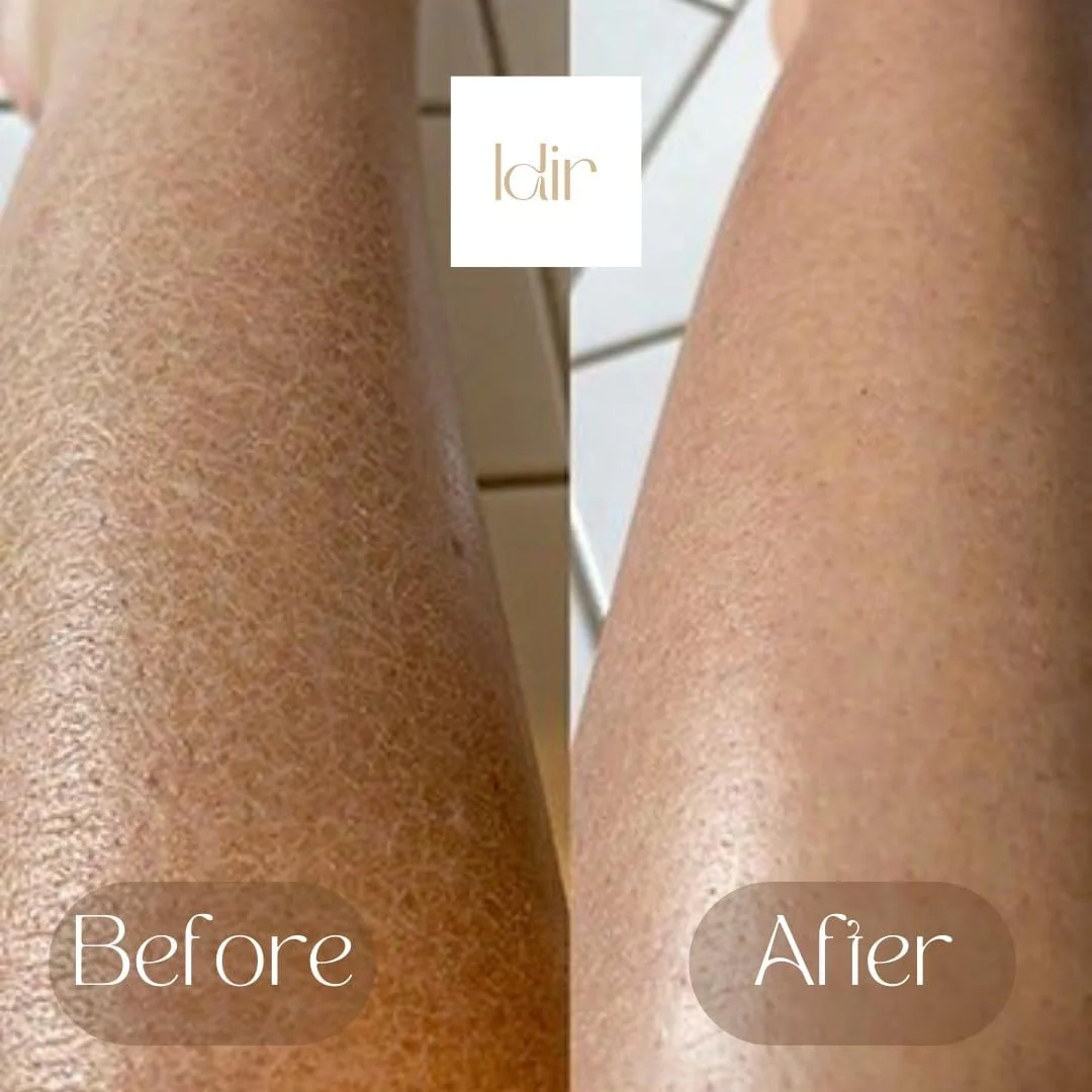 دستکش لایه بردار اورجینال IDIR - بهترین اسکرابر بدن برای پوست صاف - لیف مراکشی ملایم - دستکش لایه بردار که پوست مرده و کراتوز پیلاریس را از بین می برد - کسا بهترین پاک کننده پوست مرده.