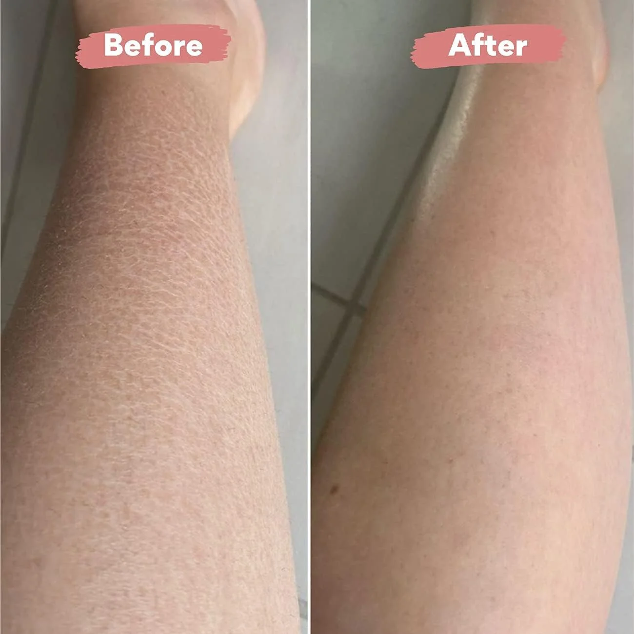 دستکش لایه بردار پوست مرده PEACHYGLO - اسکرابر بدن کره ای، دستکش عمیق برای بدن، تحریک جریان خون و درخشش جوانی، کمک به درمان کراتوز پیلاریس (1 عدد)