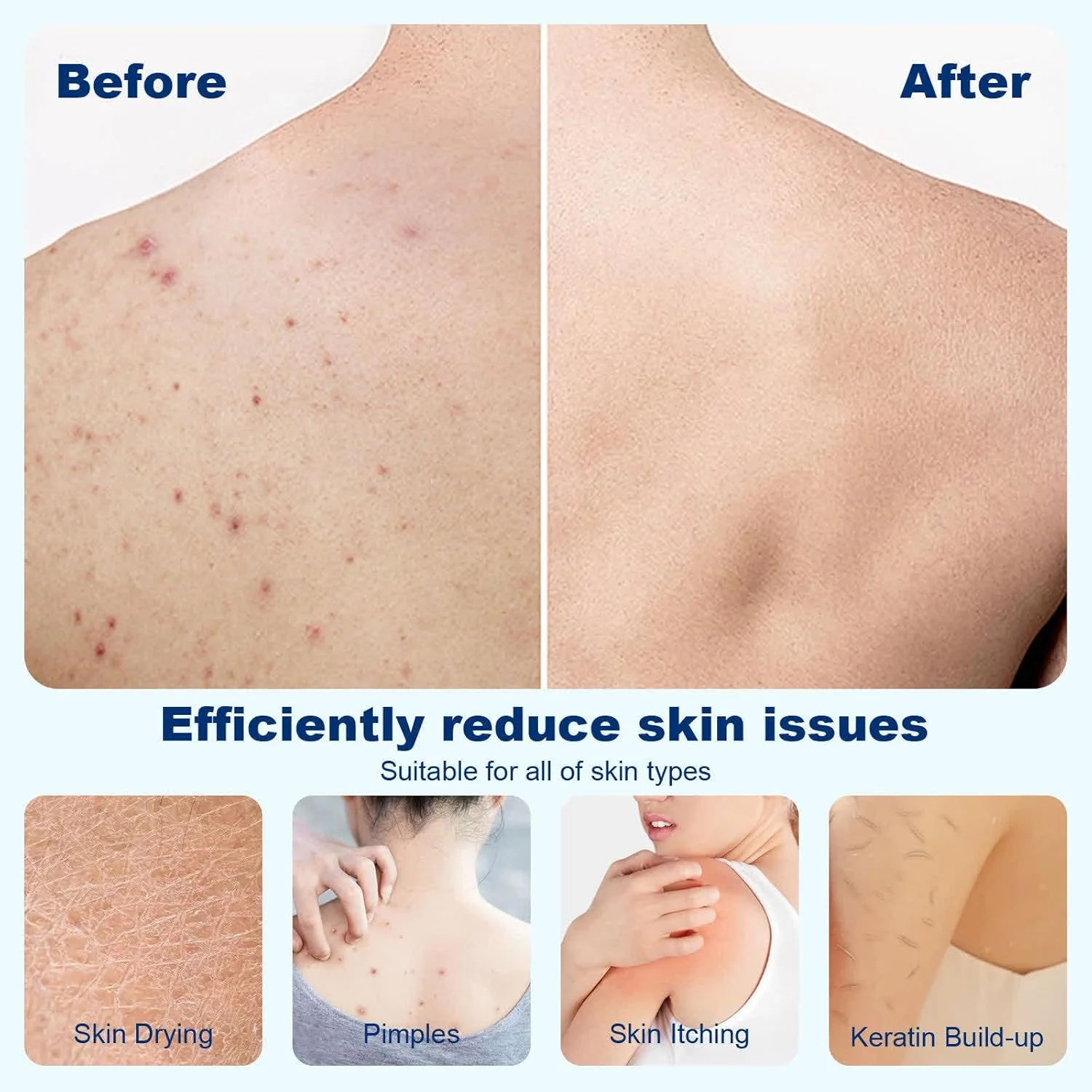 دستکش لایه بردار ممتاز 2 عددی، دستکش اسکراب بدن SPA، دستکش لایه بردار ملایم دو طرفه، الیاف ویسکوز برای پاکسازی موثر بدون تحریک پوست دستکش لایه بردار ممتاز 2 عددی، دستکش اسکراب بدن SPA، دستکش لایه بردار ملایم دو طرفه، الیاف ویسکوز برای پاکسازی موثر بدون تحریک پوست