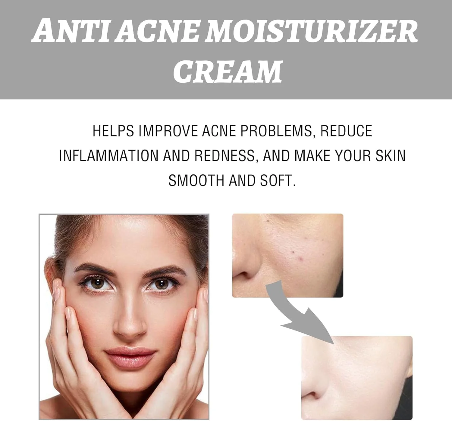 کرم ضد جوش آزونی، کرم های مرطوب کننده صورت برای پوست مستعد آکنه، کرم صورت کنترل کننده آکنه با اسید هیالورونیک، کرم های از بین برنده آکنه برای آبرسانی، مراقبت از پوست برای پوست حساس کرم ضد جوش آزونی، کرم های مرطوب کننده صورت برای پوست مستعد آکنه، کرم صورت کنترل کننده آکنه با اسید هیالورونیک، کرم های از بین برنده آکنه برای آبرسانی، مراقبت از پوست برای پوست حساس