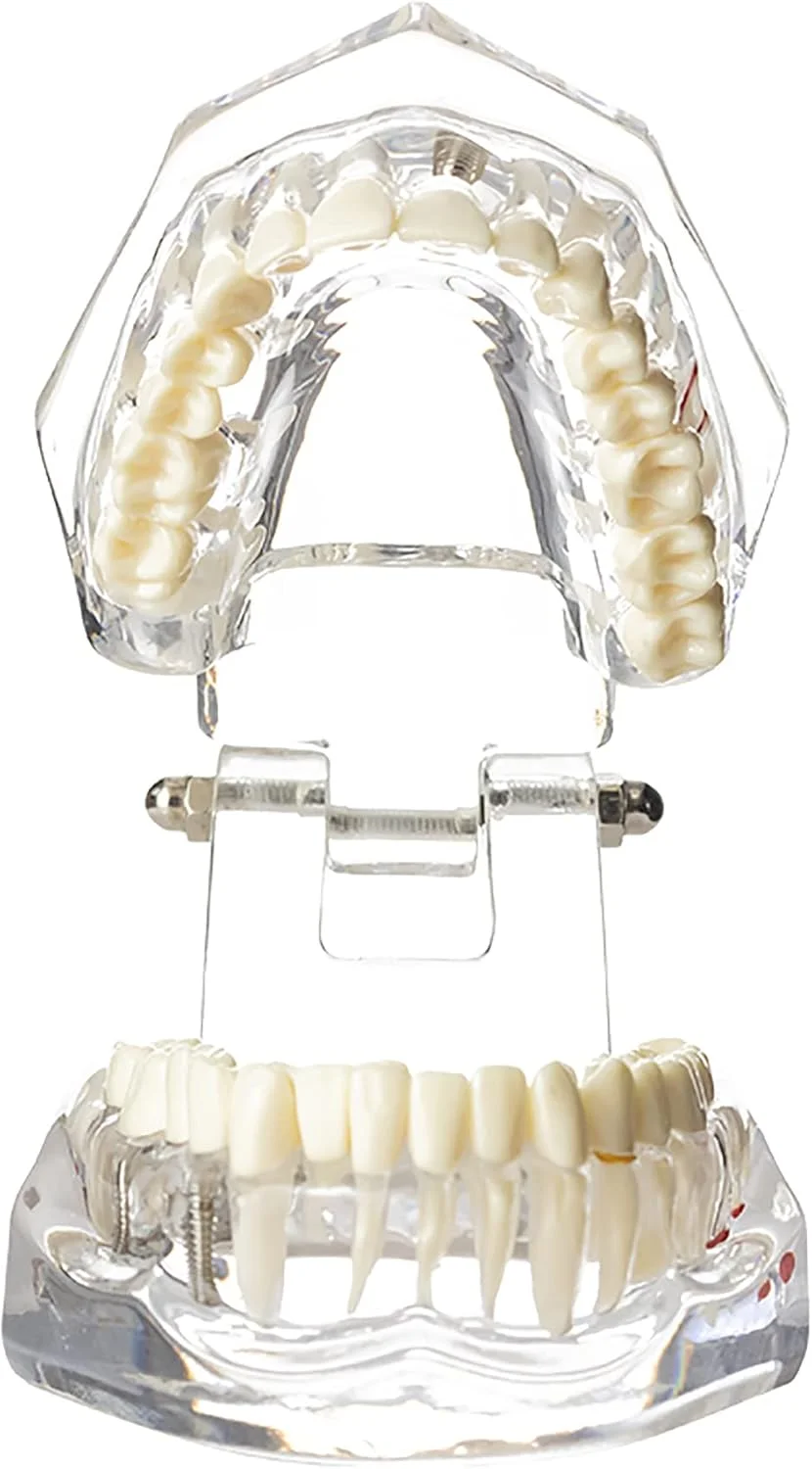 مدل دندانپزشکی Dentalmall، یک عدد، مدل تایپودنت دهانی دندان، مطالعه آناتومی آسیب شناسی ایمپلنت، آموزش نمایشی قابل جابجایی مدل دندانپزشکی Dentalmall، یک عدد، مدل تایپودنت دهانی دندان، مطالعه آناتومی آسیب شناسی ایمپلنت، آموزش نمایشی قابل جابجایی