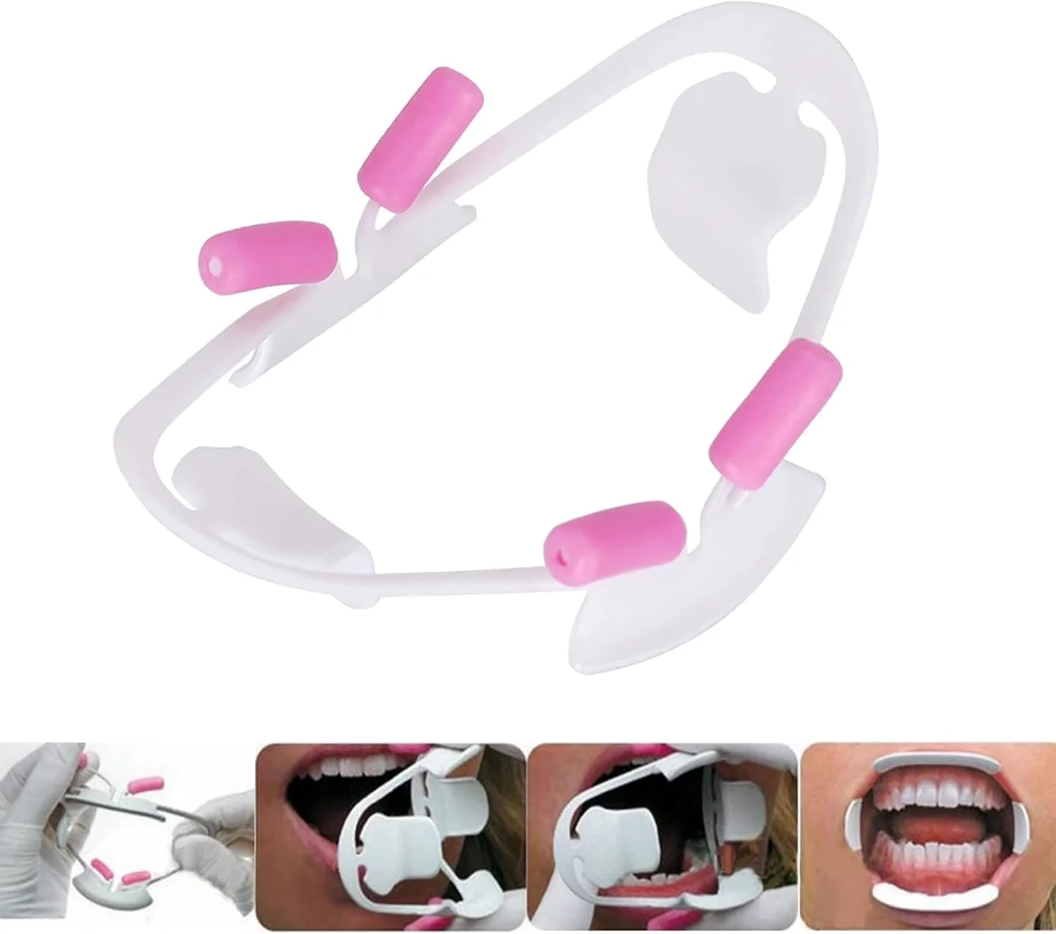 ابزار باز کننده دهان دندانپزشکی سه بعدی WZCXYX، رترکتور لب ابزار دندانپزشکی ارتودنسی حرفه ای (سایز: کوچک) ابزار باز کننده دهان دندانپزشکی سه بعدی WZCXYX، رترکتور لب ابزار دندانپزشکی ارتودنسی حرفه ای (سایز: کوچک)