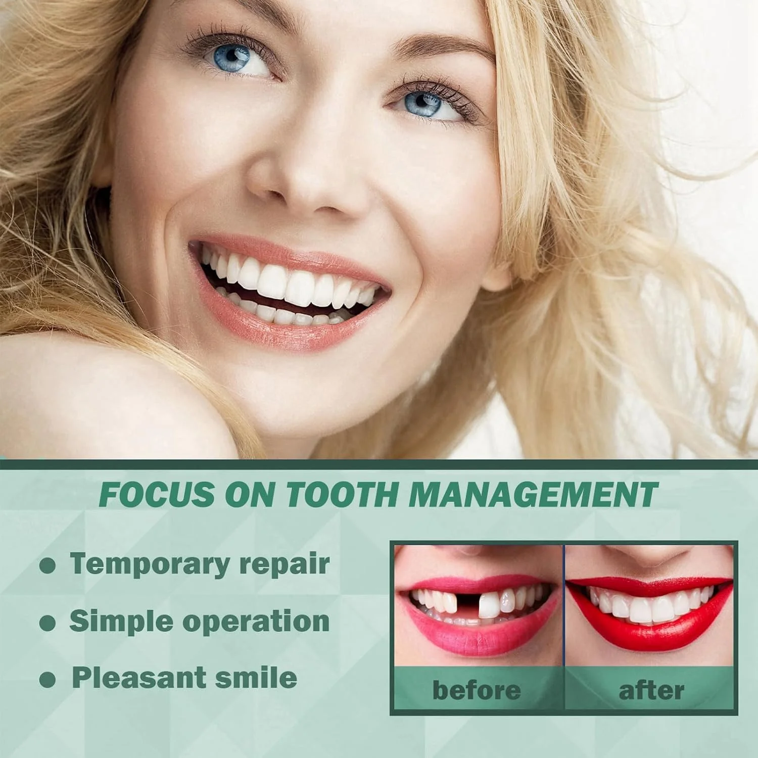 کیت موقت دندانپزشکی زیبایی، مجموعه جایگزینی دندان Azonee با 2 عدد مهره های شکل دهنده 30 میلی لیتری و 3 عدد موچین، ایده آل برای بهبود موقت دندان یا پوشش دندان شکسته