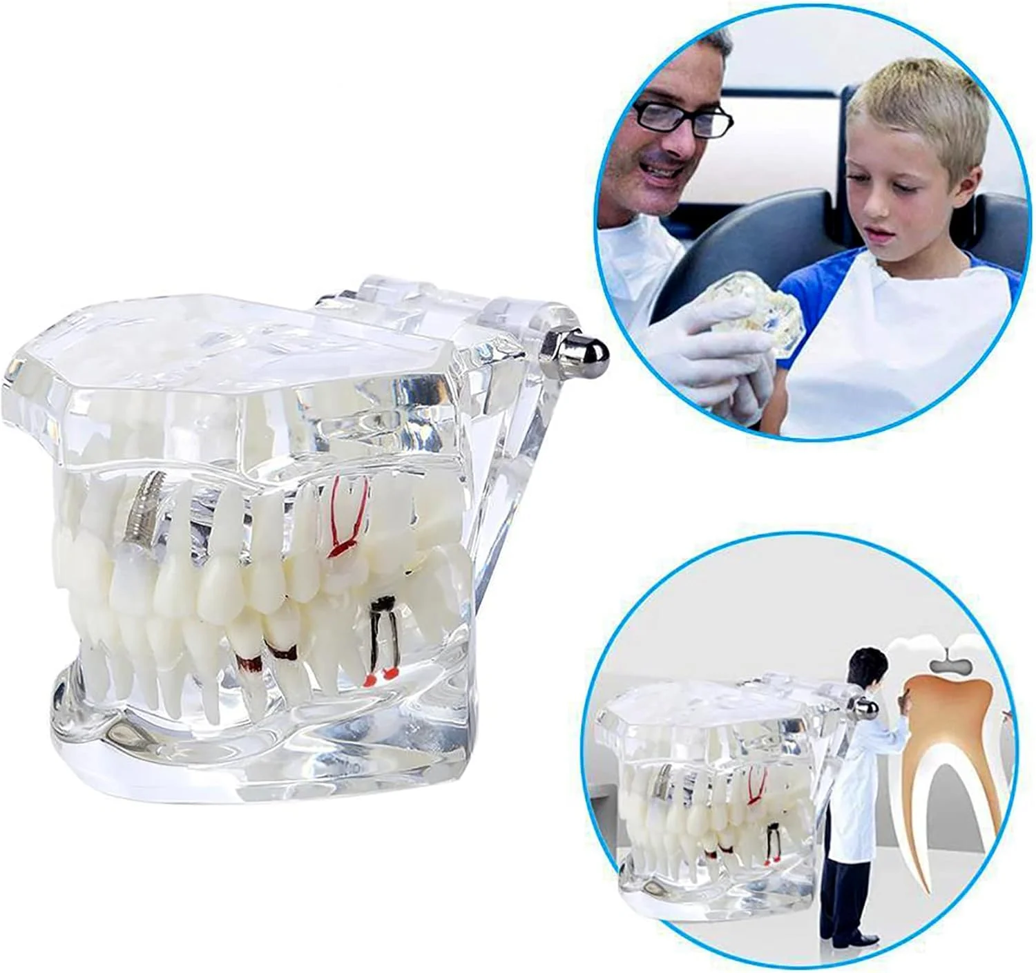 مدل دندانپزشکی Dentalmall، یک عدد، مدل تایپودنت دهانی دندان، مطالعه آناتومی آسیب شناسی ایمپلنت، آموزش نمایشی قابل جابجایی مدل دندانپزشکی Dentalmall، یک عدد، مدل تایپودنت دهانی دندان، مطالعه آناتومی آسیب شناسی ایمپلنت، آموزش نمایشی قابل جابجایی