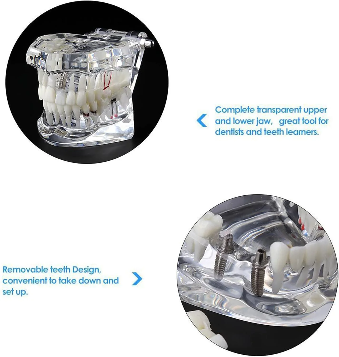 مدل دندانپزشکی Dentalmall، یک عدد، مدل تایپودنت دهانی دندان، مطالعه آناتومی آسیب شناسی ایمپلنت، آموزش نمایشی قابل جابجایی مدل دندانپزشکی Dentalmall، یک عدد، مدل تایپودنت دهانی دندان، مطالعه آناتومی آسیب شناسی ایمپلنت، آموزش نمایشی قابل جابجایی