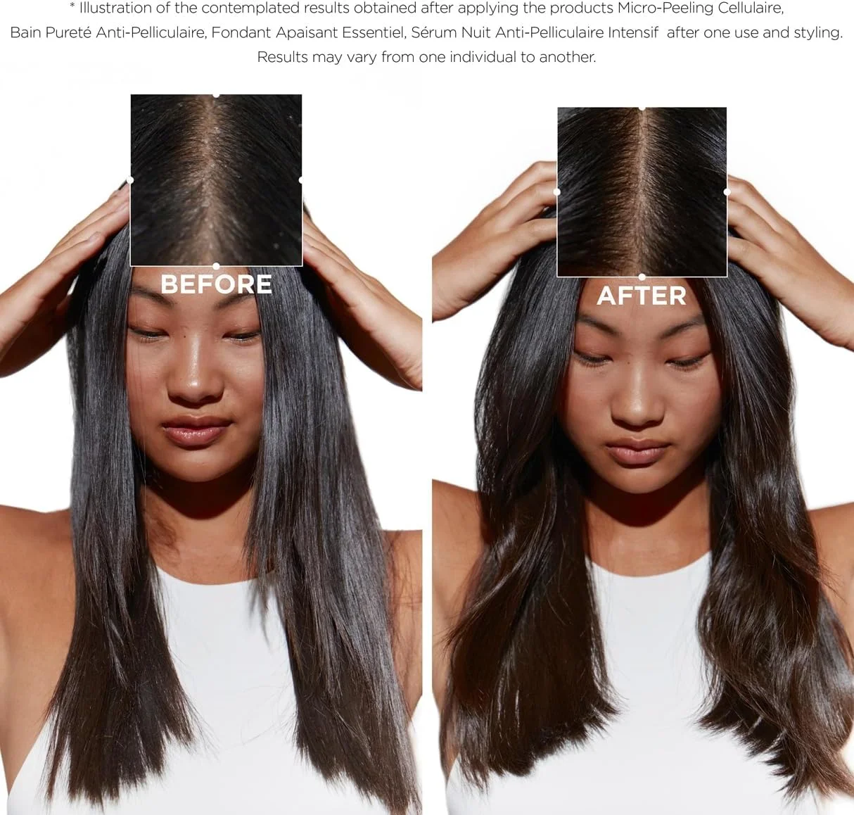 شامپو ضد شوره و پاک کننده سیمبیوز کراستاس 250 میلی لیتر