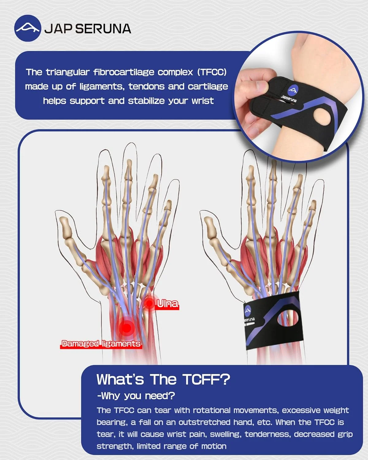 مچ بند جاپرسونا برای آسیب های TFCC - مچ بند فوق العاده نازک و قابل تنظیم برای درد مچ دست در سمت اولنار، بی ثباتی DRUJ، پشتیبانی از آسیب های ناشی از استفاده مکرر مچ دست