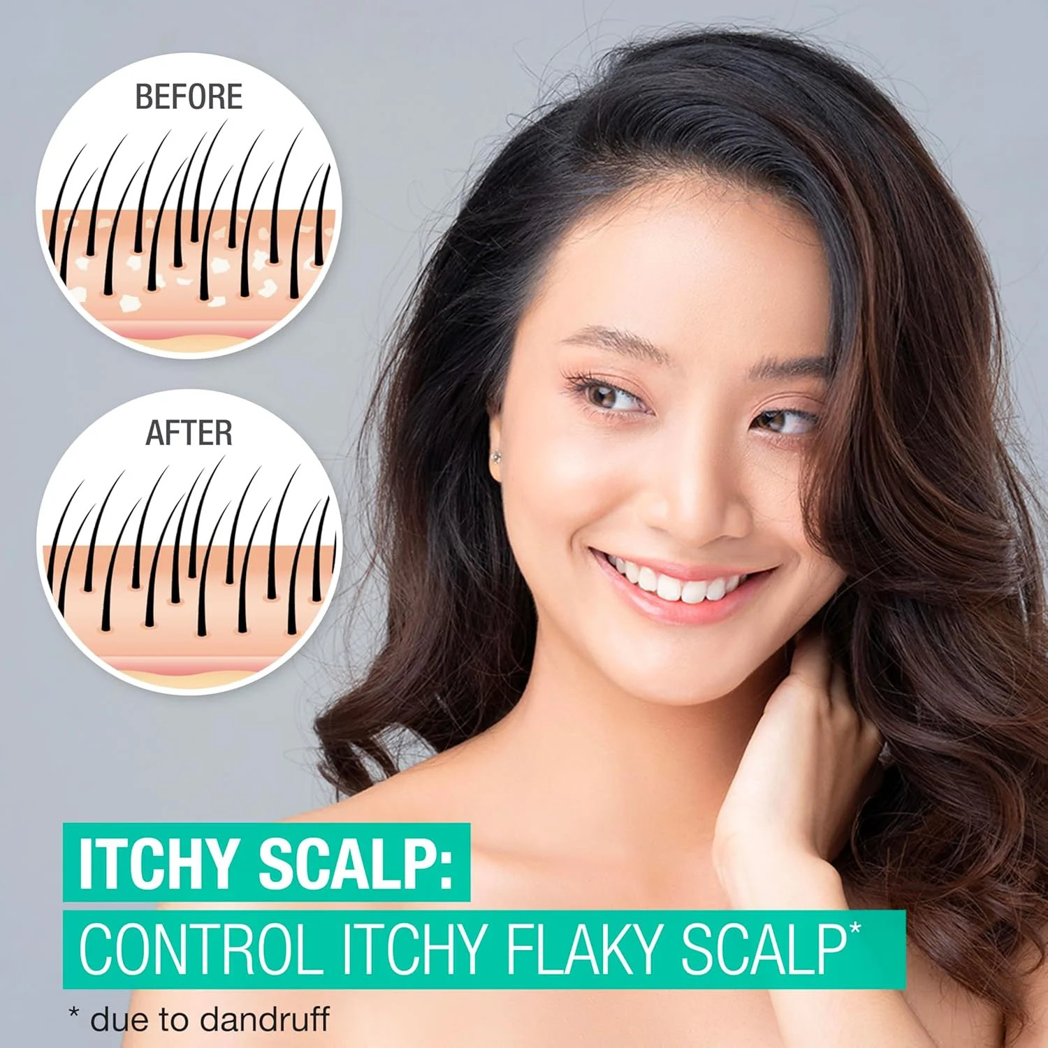 شامپو ضد شوره سر نوتروژینا، حاوی 2.5% سالیسیلیک اسید با رایحه نعناع، حجم 355 میلی لیتر شامپو ضد شوره سر نوتروژینا، حاوی 2.5% سالیسیلیک اسید با رایحه نعناع، حجم 355 میلی لیتر