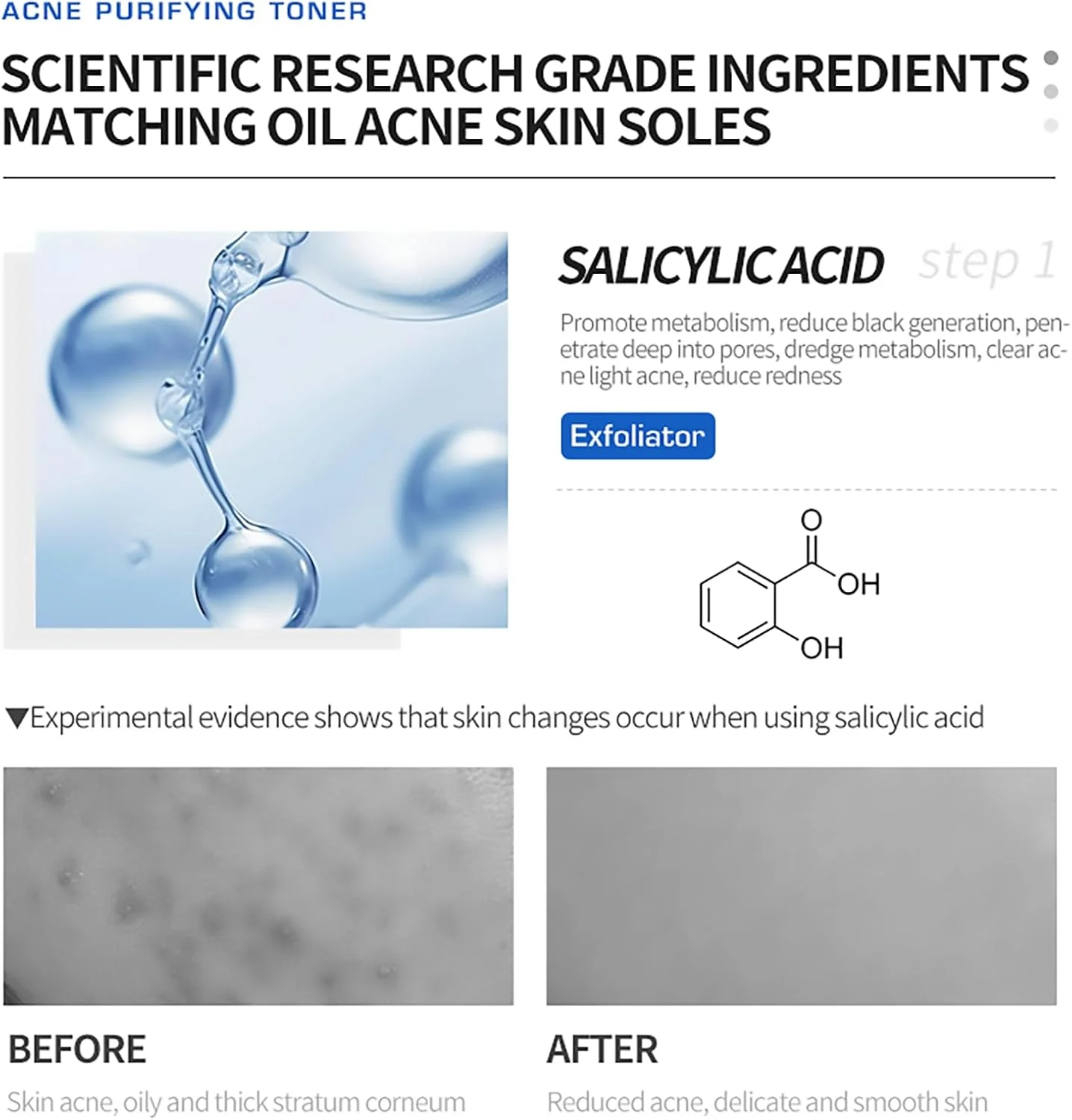 تونر پاک کننده آکنه برند کره‌ای DEleventh حجم 30 میلی لیتر / حاوی اسید سالیسیلیک و عصاره‌های گیاهی برای ضد آکنه، تسکین دهنده، رفع انسداد منافذ، کنترل چربی و حفظ پوستی شاداب و بدون لک