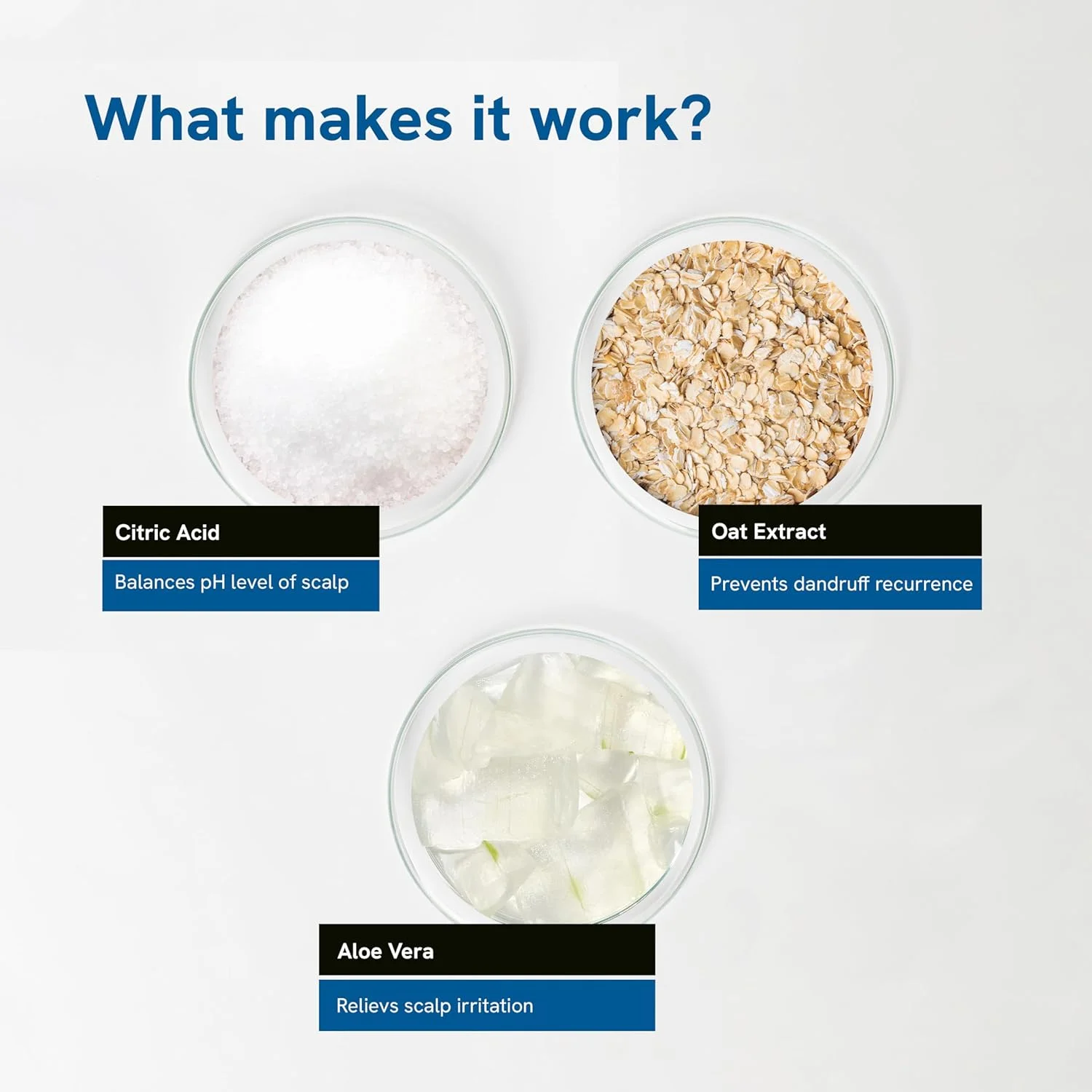 شامپو ضد شوره بادی وایز 150 میلی لیتر | pH 5.5 | مواد فعال اثبات شده بالینی با اسید سیتریک، عصاره جو دوسر و آلوئه ورا | فاقد پارابن و وگان