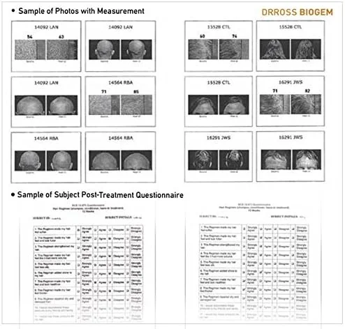 شامپو احیا کننده موهای چرب دکتر pH-Balanced بایوجم (دکتر راس) - 355 میلی لیتر شامپو احیا کننده موهای چرب دکتر pH-Balanced بایوجم (دکتر راس) - 355 میلی لیتر