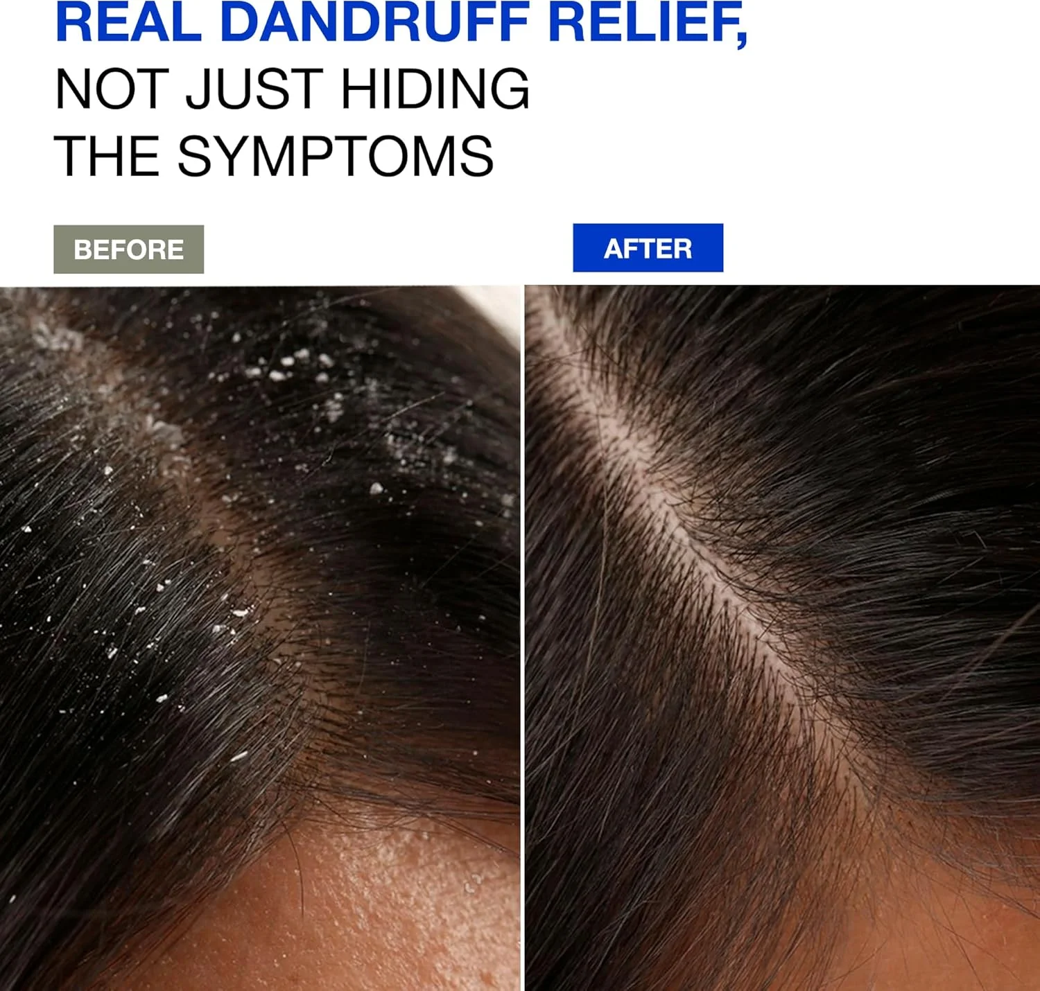 شامپو سم زدای ضد شوره فلاریو. پاک کننده پوست سر، از بین برنده شوره سر و موهای چرب، حجم دهنده، دارای اثر تقویت کننده و پاک کننده. به موهای سالم و تمیز خود بازگردید (300 میلی لیتر) شامپو سم زدای ضد شوره فلاریو. پاک کننده پوست سر، از بین برنده شوره سر و موهای چرب، حجم دهنده، دارای اثر تقویت کننده و پاک کننده. به موهای سالم و تمیز خود بازگردید (300 میلی لیتر)