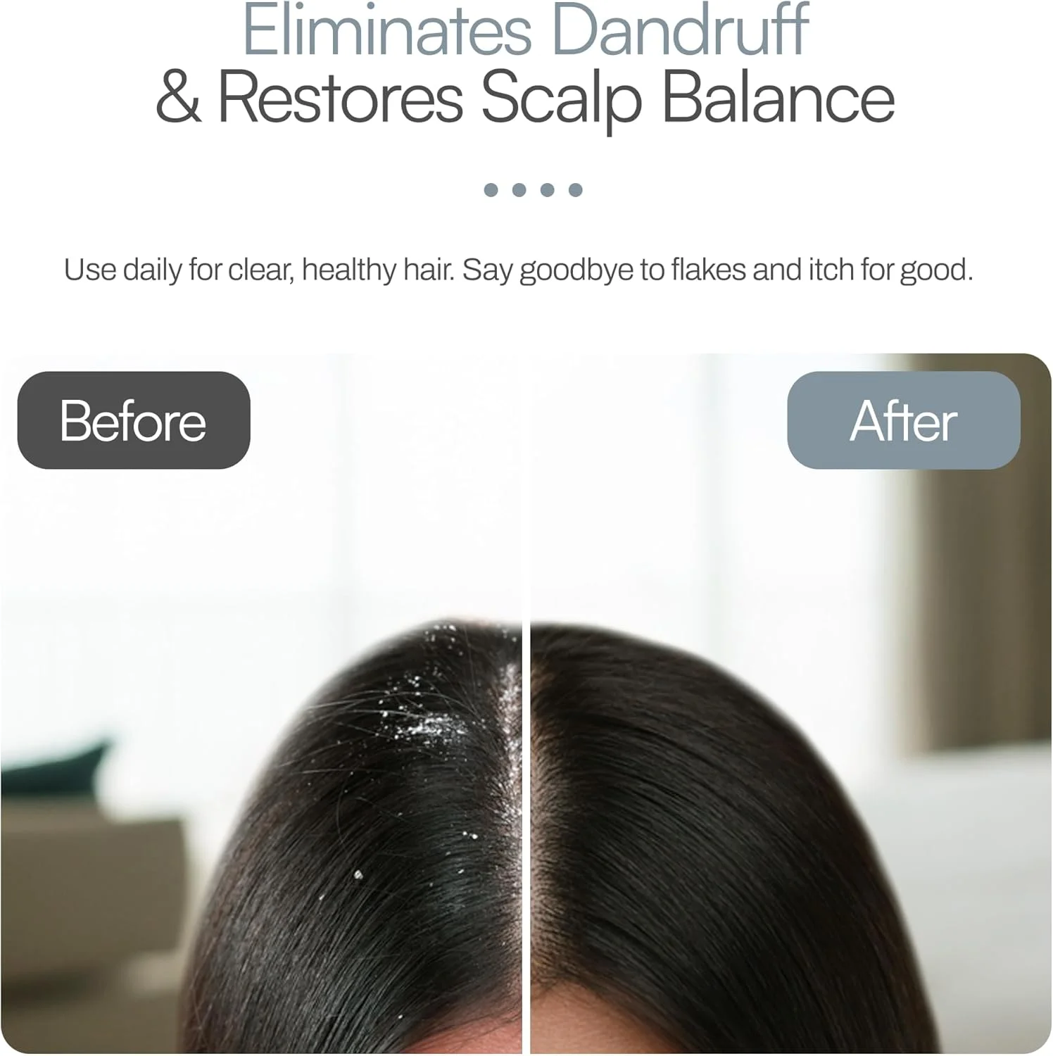 شامپو ضد شوره فولتن مناسب پوست سر چرب و پوسته دار 200 میلی لیتر شامپو ضد شوره فولتن مناسب پوست سر چرب و پوسته دار 200 میلی لیتر