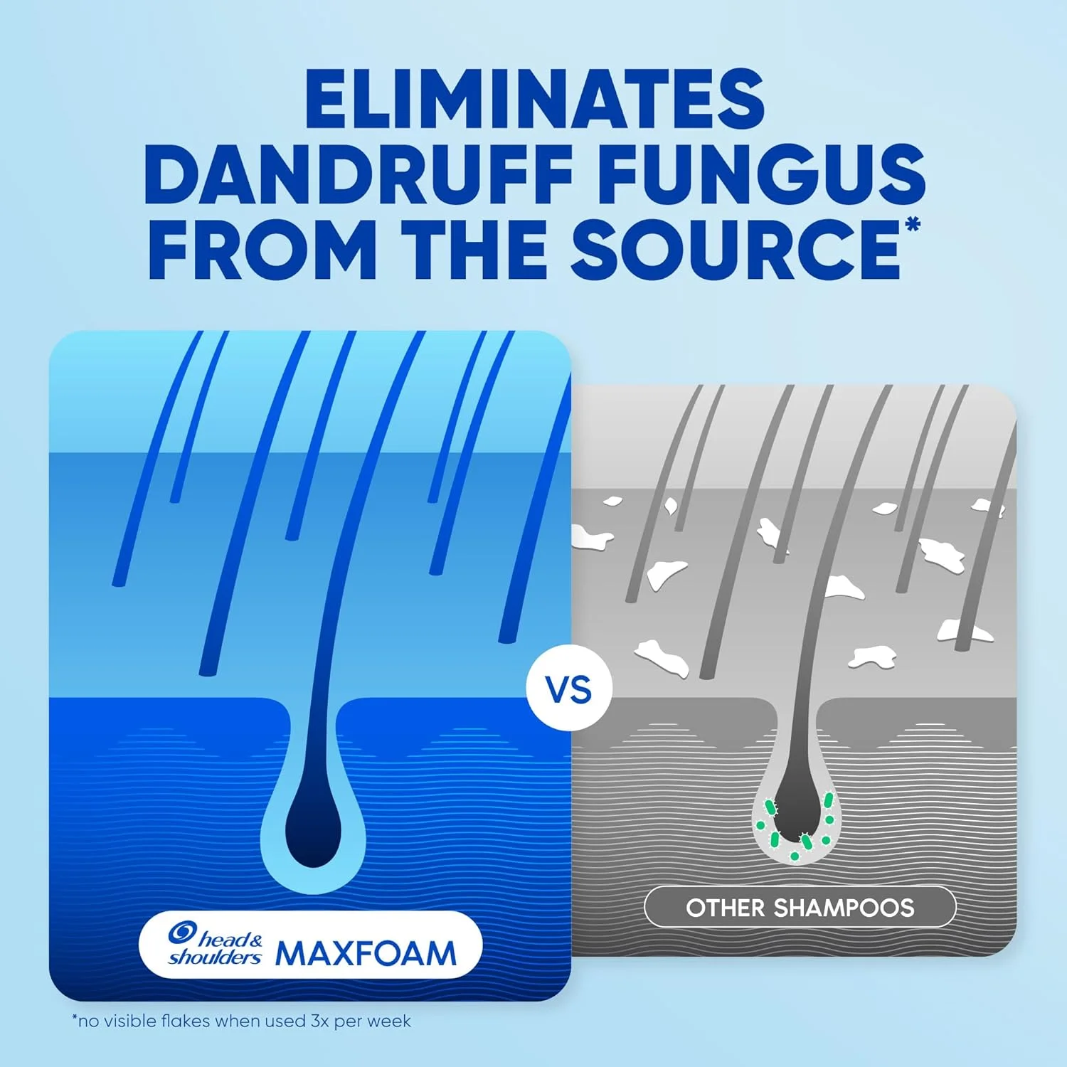 شامپو ضد شوره موهای چرب Head & Shoulders با رایحه مرکبات، 400 میلی لیتر شامپو ضد شوره موهای چرب Head & Shoulders با رایحه مرکبات، 400 میلی لیتر