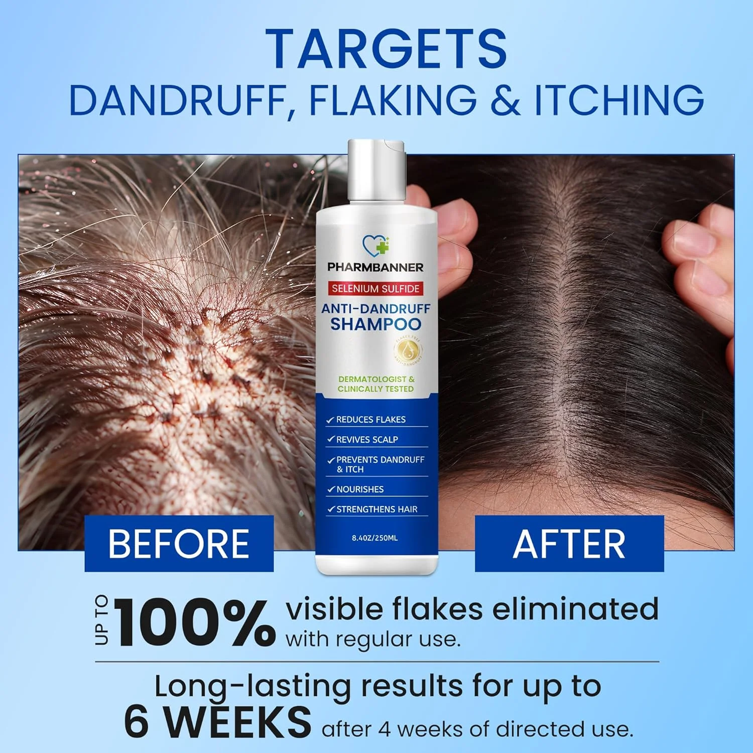 شامپو ضد شوره سلنیوم سولفاید PHARMBANNER: برای پوست سر پوسته پوسته، خارش و تسکین درماتیت سبورئیک - منتول و روغن اسطوخودوس - مرطوب کننده، ایمن برای موهای رنگ شده، ملایم برای انواع مو - 250 میلی لیتر