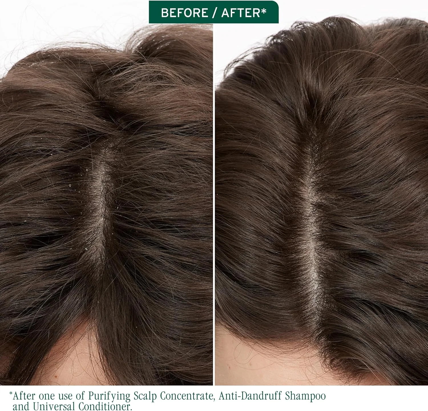 شامپو ضد شوره سر بایولاج اسکالپ سینک ۱۰۰۰ میلی لیتر