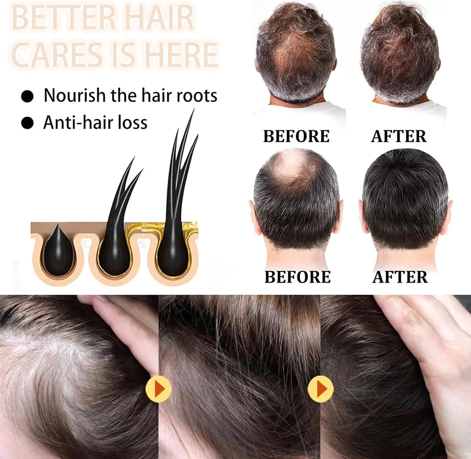 شامپو بار نارگیل KASTWAVE، شامپو بار جامد سفید، صابون بار نارگیل ارگانیک طبیعی 70 گرم، تغذیه کننده عمیق، شامپو ضد ریزش مو برای زنان و مردان، حاوی روغن نارگیل، روغن جوجوبا (سفید)