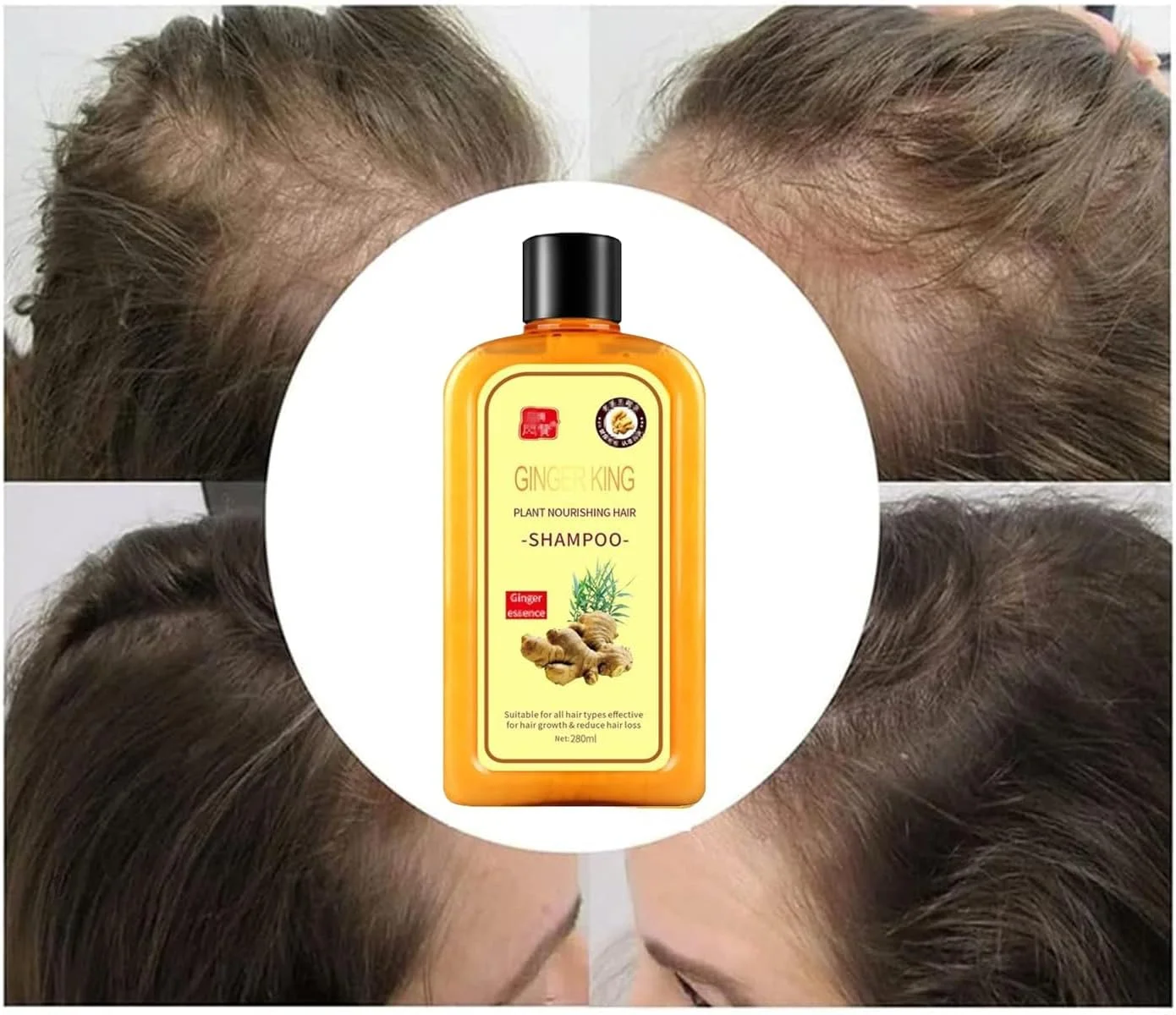 شامپو زنجبیل فوری Lomnoeza Ginaday برای رشد مجدد مو، شامپو زنجبیل برای رشد مو، شامپو مراقبت از مو زنجبیل، شامپو ضد ریزش مو زنجبیل (280 میلی لیتر/1 عدد) شامپو زنجبیل فوری Lomnoeza Ginaday برای رشد مجدد مو، شامپو زنجبیل برای رشد مو، شامپو مراقبت از مو زنجبیل، شامپو ضد ریزش مو زنجبیل (280 میلی لیتر/1 عدد)