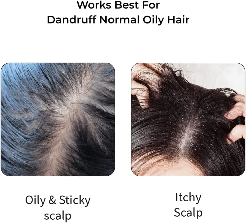 مجموعه مراقبت از موی آیورودیک ودیکس، روغن موی سفارشی و شامپو ضد شوره برای موهای معمولی/چرب با پوست سر خشک و موهای موج دار - 200 میلی لیتر مجموعه مراقبت از موی آیورودیک ودیکس، روغن موی سفارشی و شامپو ضد شوره برای موهای معمولی/چرب با پوست سر خشک و موهای موج دار - 200 میلی لیتر