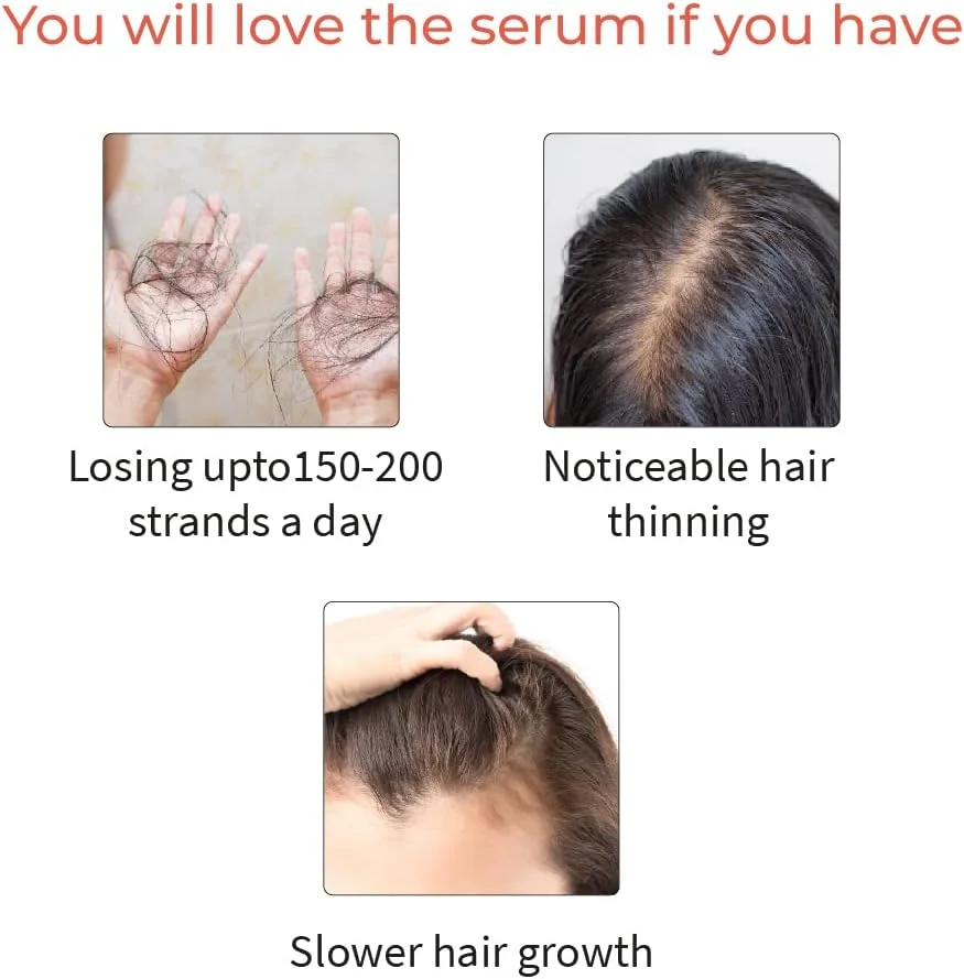 مجموعه مراقبت از موی آیورودیک ودیکس، سرم سفارشی رشد مو و شامپو ضد ریزش مو برای موهای معمولی و چرب - 150 میلی لیتر مجموعه مراقبت از موی آیورودیک ودیکس، سرم سفارشی رشد مو و شامپو ضد ریزش مو برای موهای معمولی و چرب - 150 میلی لیتر