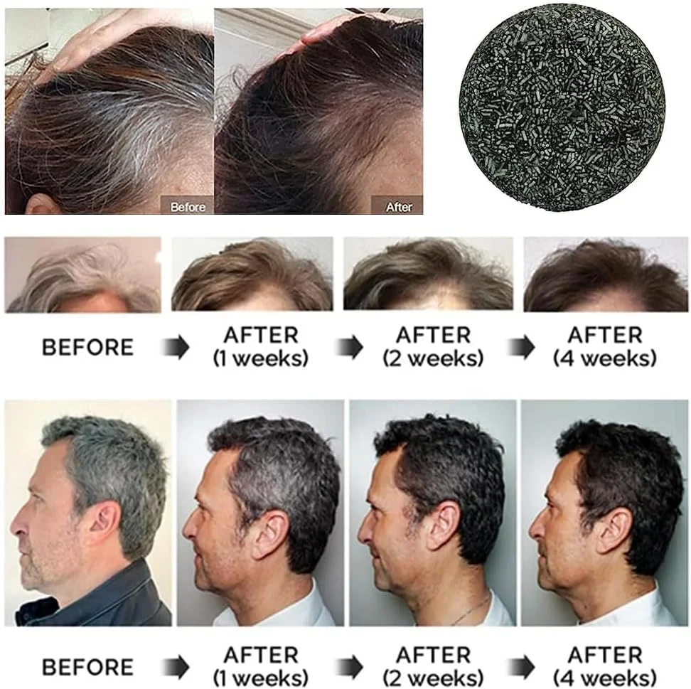 شامپو بار تقویت کننده مو TERRIFI، 2 عدد شامپو بار طبیعی، ضد شوره، درمان ریزش مو، تقویت کننده رشد مو برای انواع مو (2 عددی، خاکستری) شامپو بار تقویت کننده مو TERRIFI، 2 عدد شامپو بار طبیعی، ضد شوره، درمان ریزش مو، تقویت کننده رشد مو برای انواع مو (2 عددی، خاکستری)