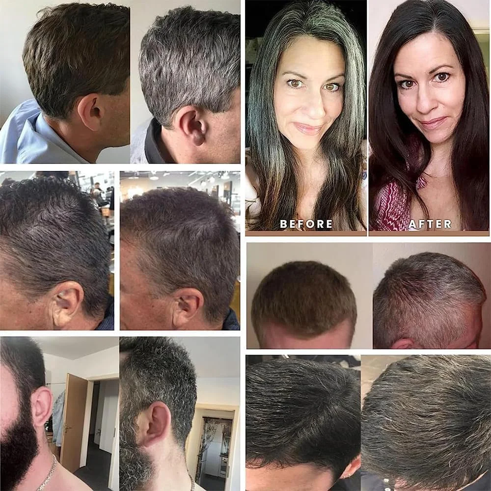 شامپو بار تقویت کننده مو TERRIFI، 2 عدد شامپو بار طبیعی، ضد شوره، درمان ریزش مو، تقویت کننده رشد مو برای انواع مو (2 عددی، خاکستری) شامپو بار تقویت کننده مو TERRIFI، 2 عدد شامپو بار طبیعی، ضد شوره، درمان ریزش مو، تقویت کننده رشد مو برای انواع مو (2 عددی، خاکستری)