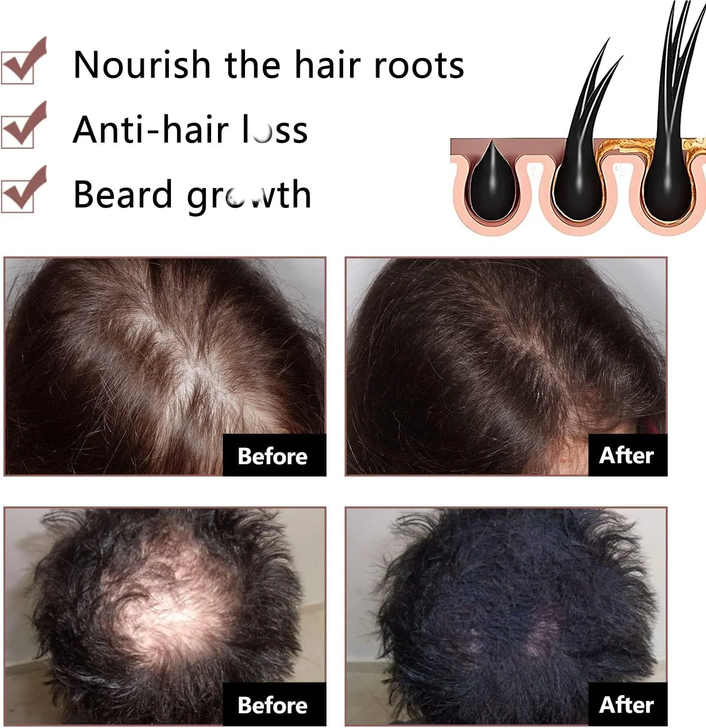 شامپو صابونی شو وو Rhomba، حاوی عصاره شو وو، پاک کننده عمیق مو و پوست سر، تقویت کننده رشد مو و جلوگیری از ریزش مو (2 عدد) شامپو صابونی شو وو Rhomba، حاوی عصاره شو وو، پاک کننده عمیق مو و پوست سر، تقویت کننده رشد مو و جلوگیری از ریزش مو (2 عدد)