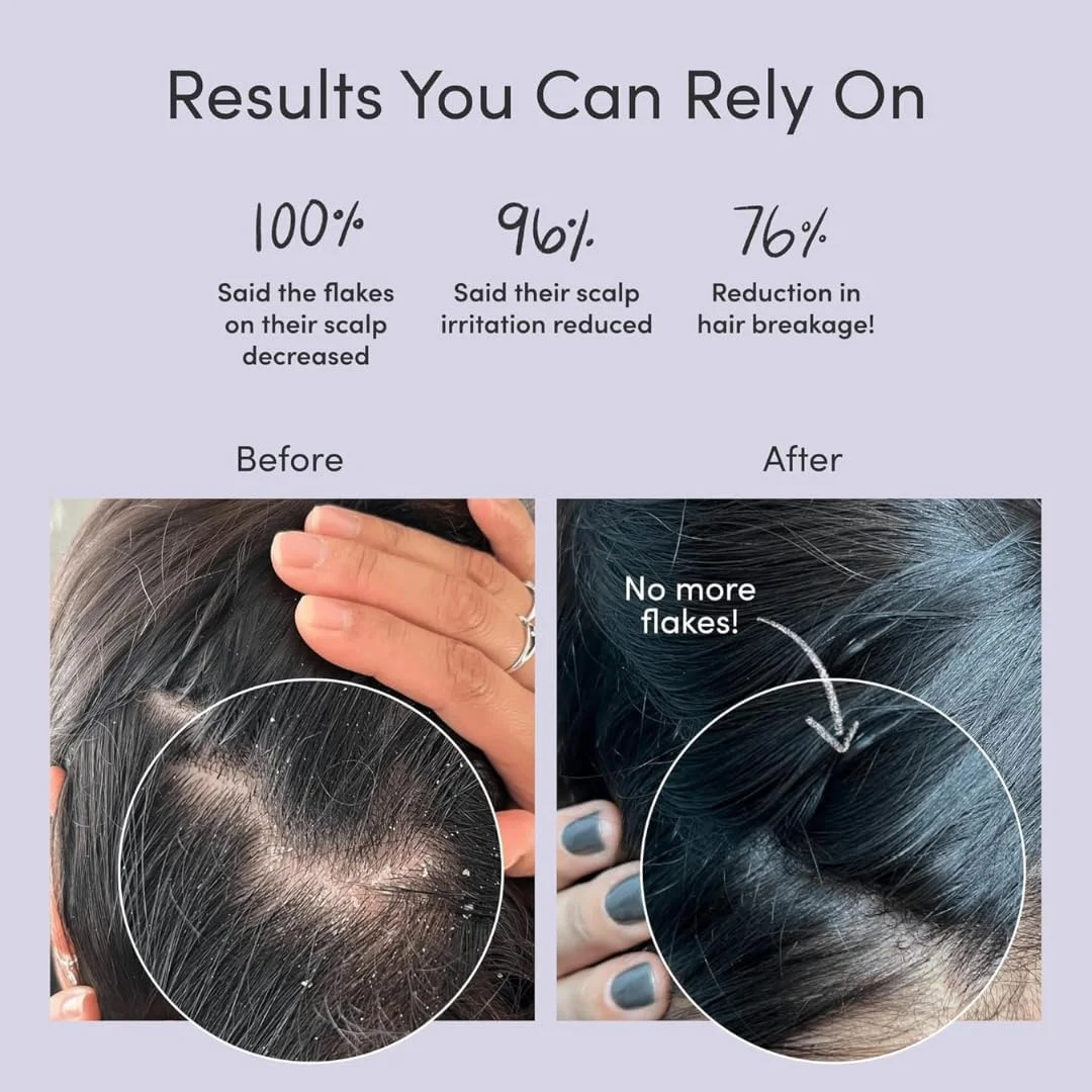 شامپو ضد شوره راول، مبارزه با پوسته ها و تسکین دهنده تحریک پوست سر، کاهش خارش و جلوگیری از شوره سر، برای انواع مو، آقایان و بانوان - 200 میلی لیتر