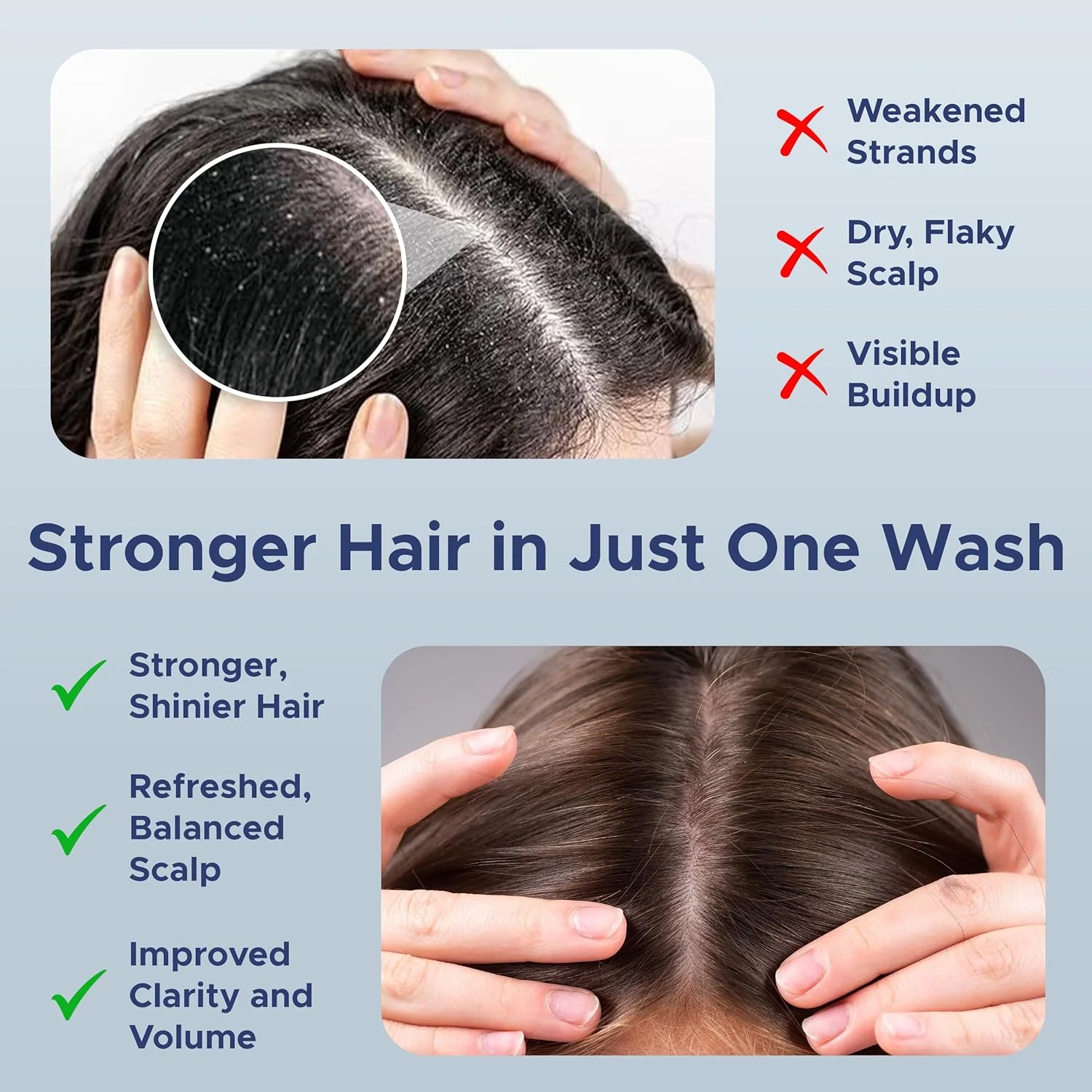 شامپو سیر کلاسیک نورا راس – شامپو ضخیم کننده و رشد مو برای آقایان و بانوان با موهای معمولی تا خشک و نازک – فرمول پاک کننده طبیعی ضد شوره و پوست سر با رزماری – 946 میلی لیتر شامپو سیر کلاسیک نورا راس – شامپو ضخیم کننده و رشد مو برای آقایان و بانوان با موهای معمولی تا خشک و نازک – فرمول پاک کننده طبیعی ضد شوره و پوست سر با رزماری – 946 میلی لیتر