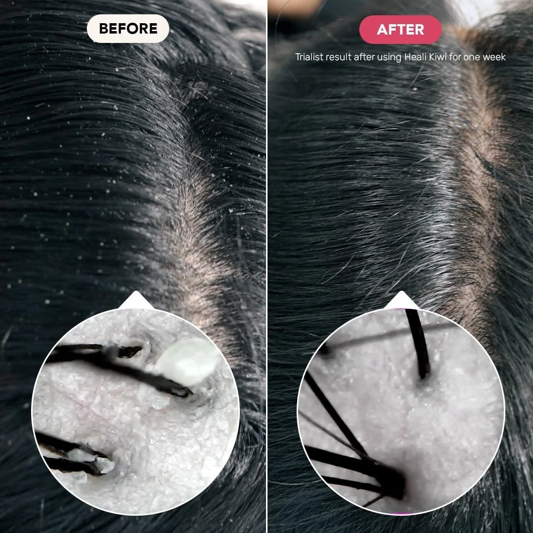 شامپو جامد دوستدار محیط زیست Ethique برای شوره سر یا پوست سر حساس، Heali Kiwi 110 گرم