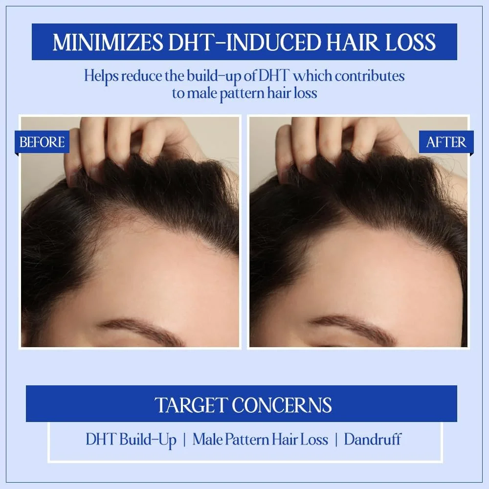 شامپو مسدود کننده DHT آیورودیک TYC - TRUST YOUR CHOICE | پاک کننده عمیق، ضد خارش و ضد شوره | بدون سولفات | شامپو و نرم کننده ارگانیک 3 در 1 | 300 میلی لیتر شامپو مسدود کننده DHT آیورودیک TYC - TRUST YOUR CHOICE | پاک کننده عمیق، ضد خارش و ضد شوره | بدون سولفات | شامپو و نرم کننده ارگانیک 3 در 1 | 300 میلی لیتر