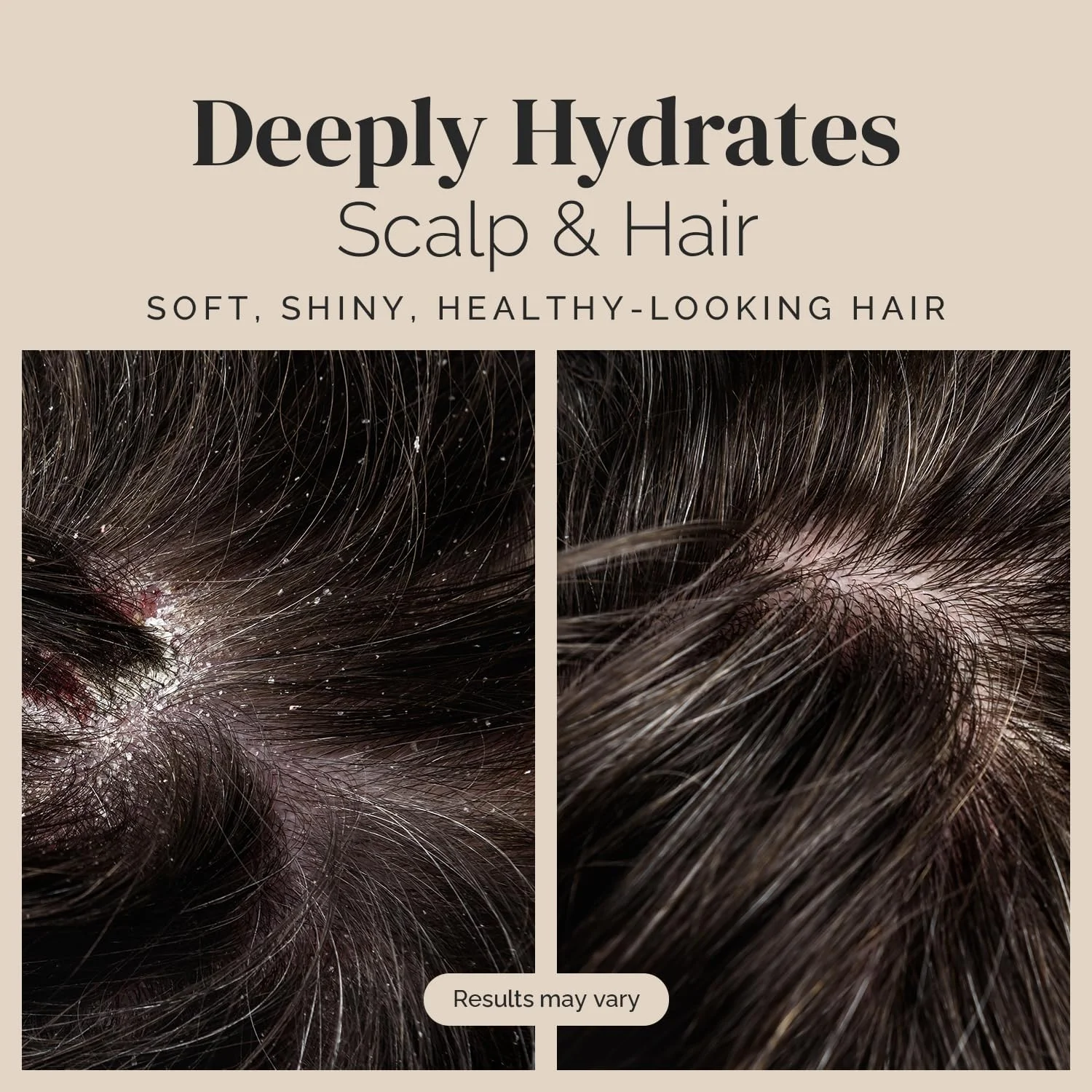 شامپو روغن درخت چای بدون سولفات پوریا برای پوست سر خشک و پوسته پوسته 473 میلی لیتر - برنده جایزه - شامپو مرطوب کننده، آبرسان و ایمن برای موهای رنگ شده، مناسب برای آقایان و بانوان. فاقد پارابن، بدون تست حیوانی، حاوی رزماری، آرنیکا و مریم گلی شامپو روغن درخت چای بدون سولفات پوریا برای پوست سر خشک و پوسته پوسته 473 میلی لیتر - برنده جایزه - شامپو مرطوب کننده، آبرسان و ایمن برای موهای رنگ شده، مناسب برای آقایان و بانوان. فاقد پارابن، بدون تست حیوانی، حاوی رزماری، آرنیکا و مریم گلی